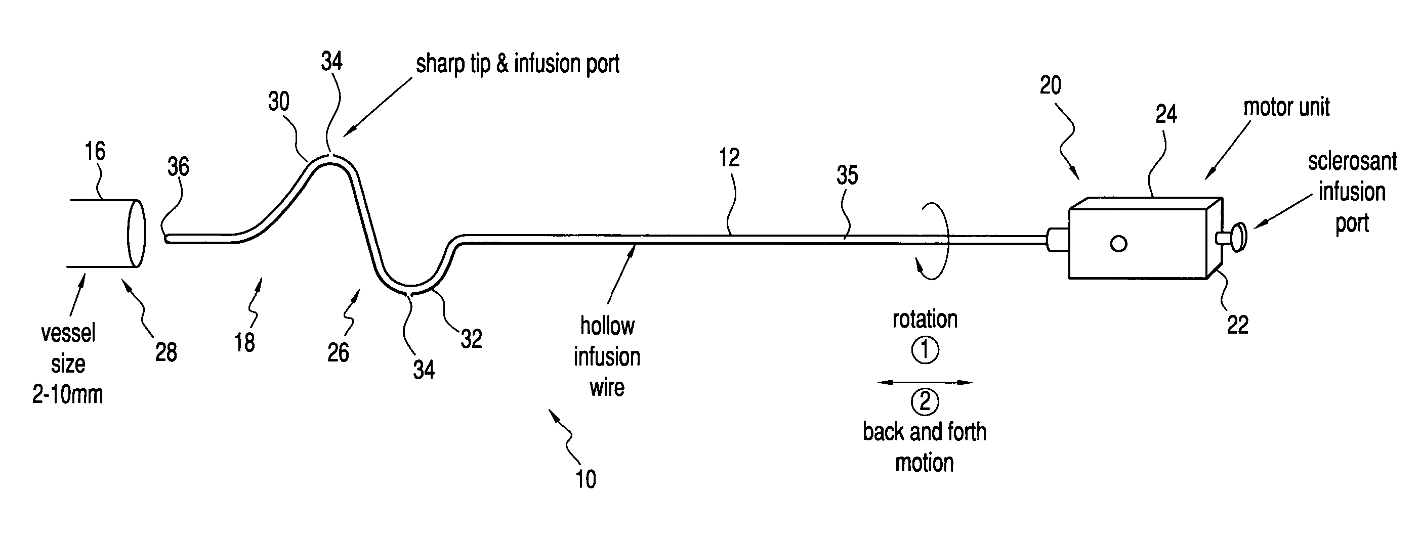 Vascular ablation apparatus and method