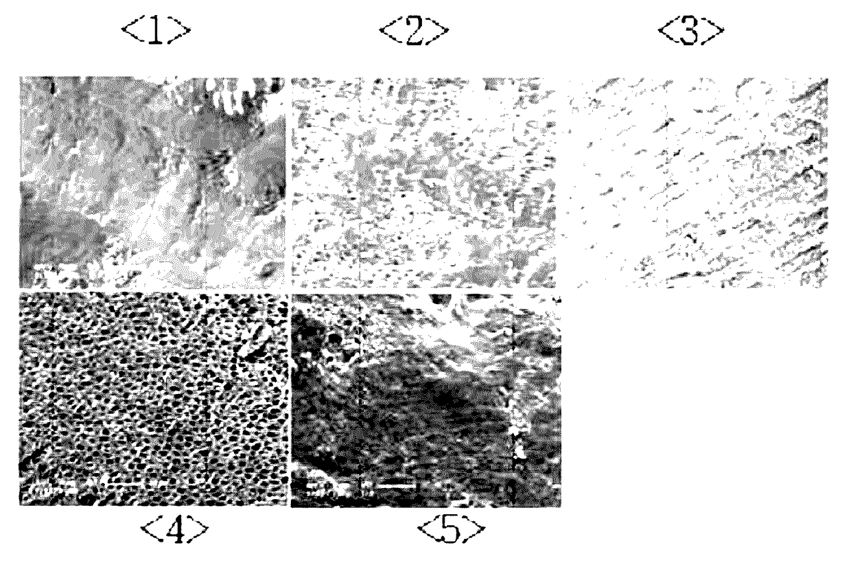 Method for producing a bone transplant material, and bone transplant material produced by same