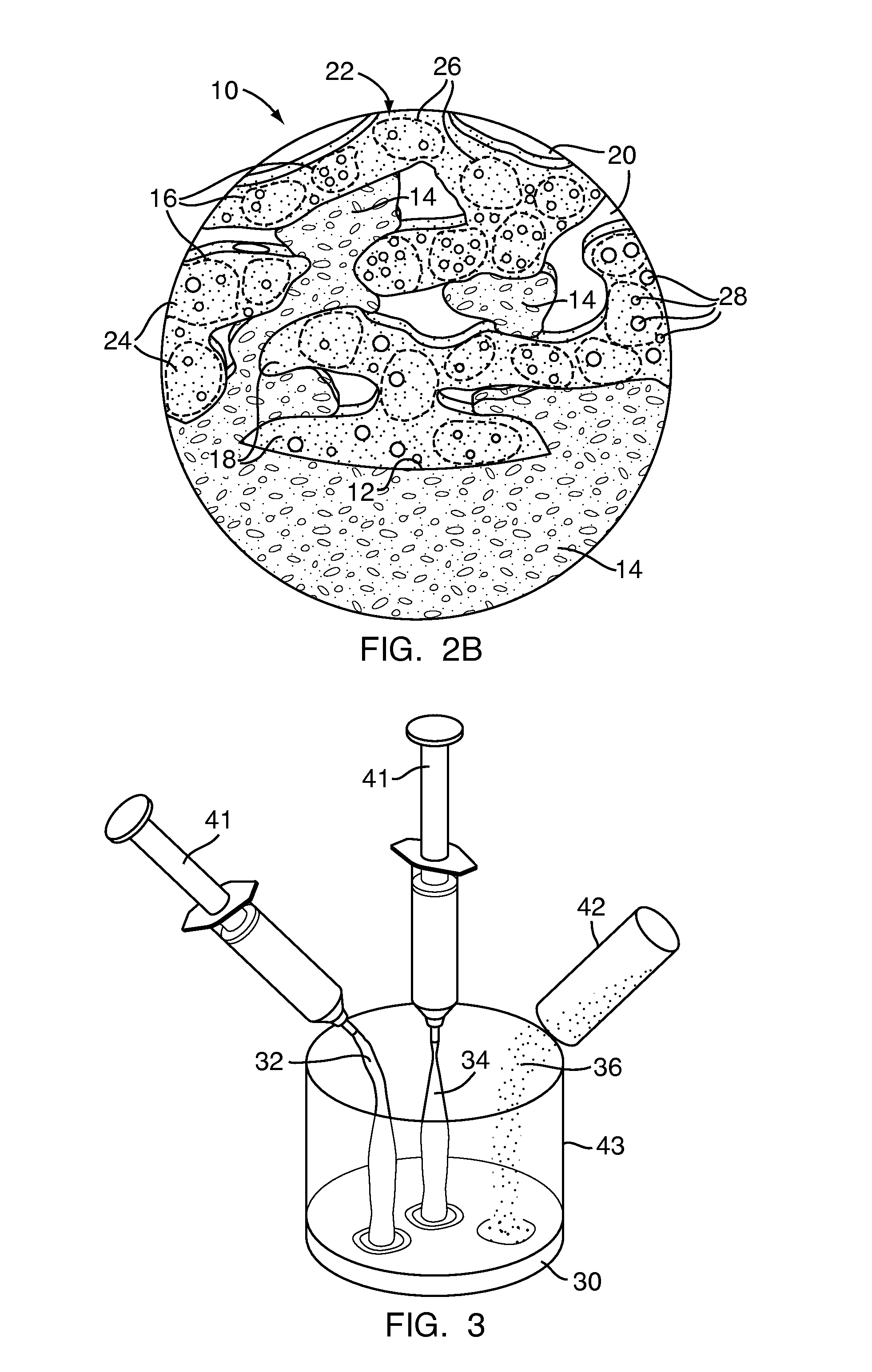 Polymeric bone defect filler