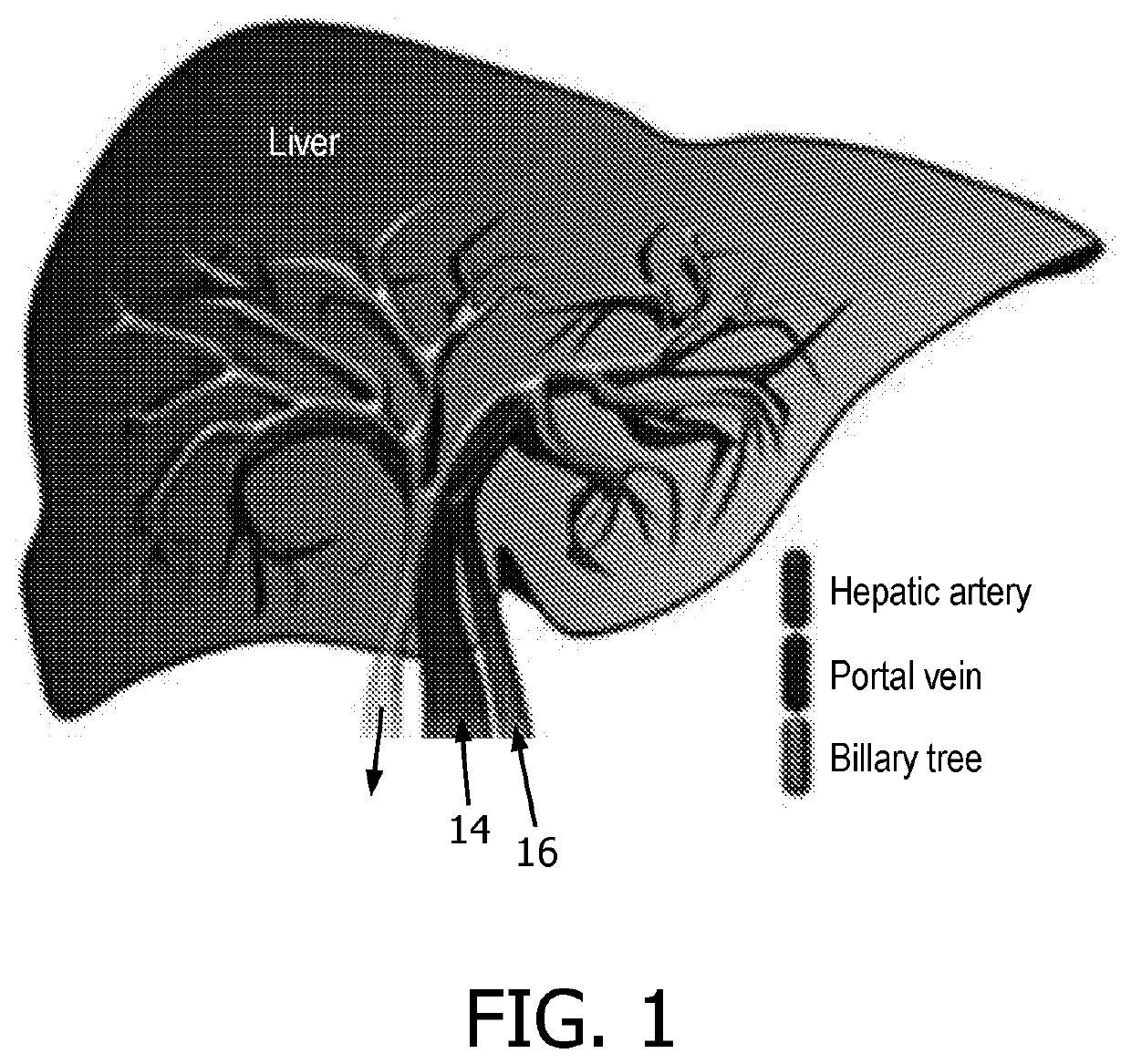 Time-based parametric contrast enhanced ultrasound imaging system and method