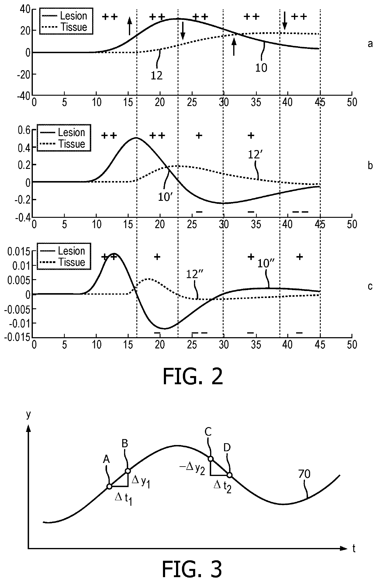 Time-based parametric contrast enhanced ultrasound imaging system and method