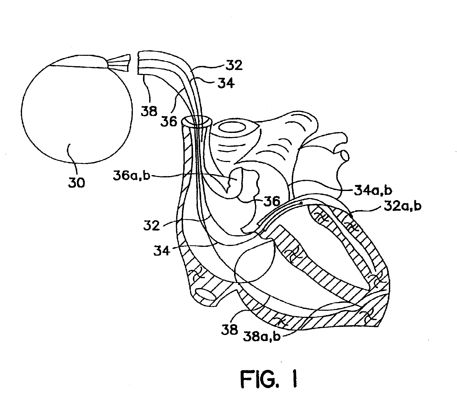 Algorithm for the automatic determination of optimal AV and VV intervals