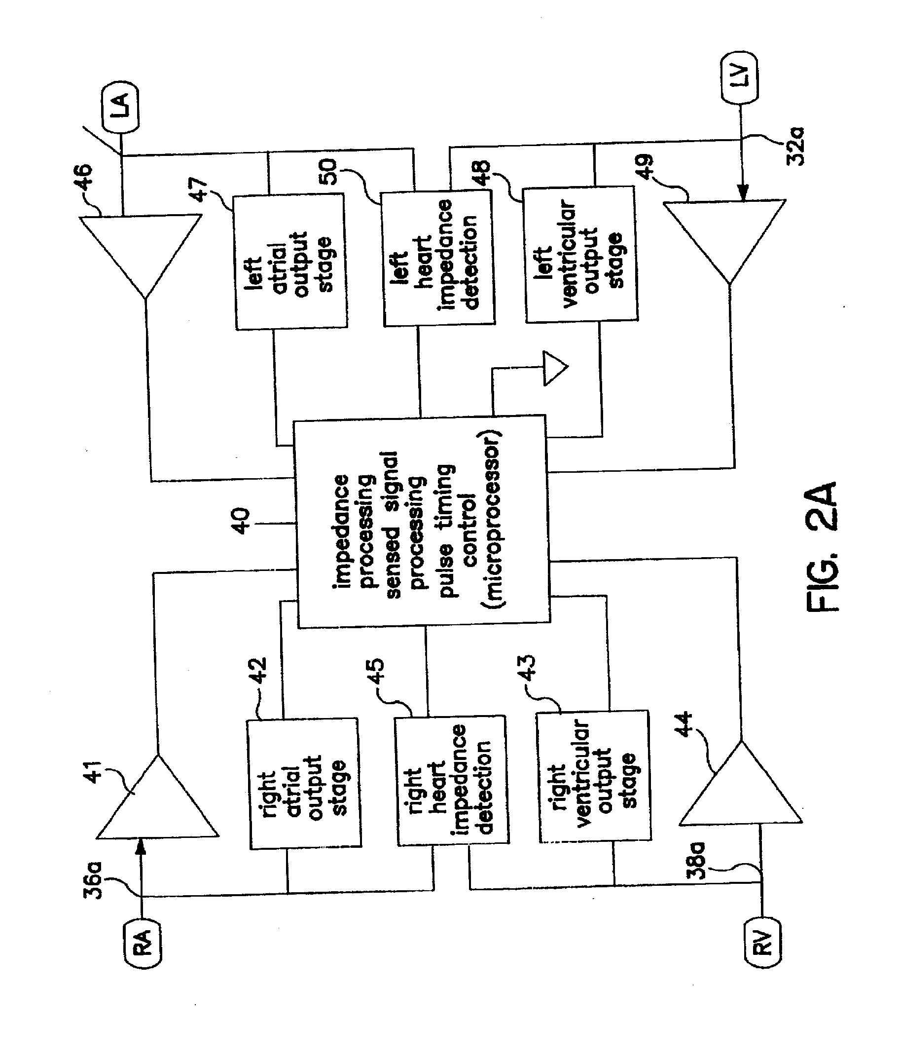 Algorithm for the automatic determination of optimal AV and VV intervals