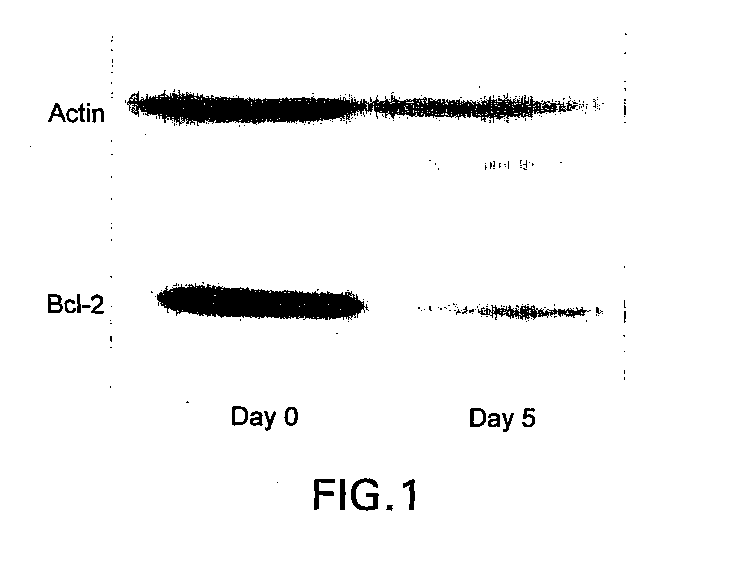 Methods of treatment of a bcl-2 disorder using bcl-2 antisense oligomers