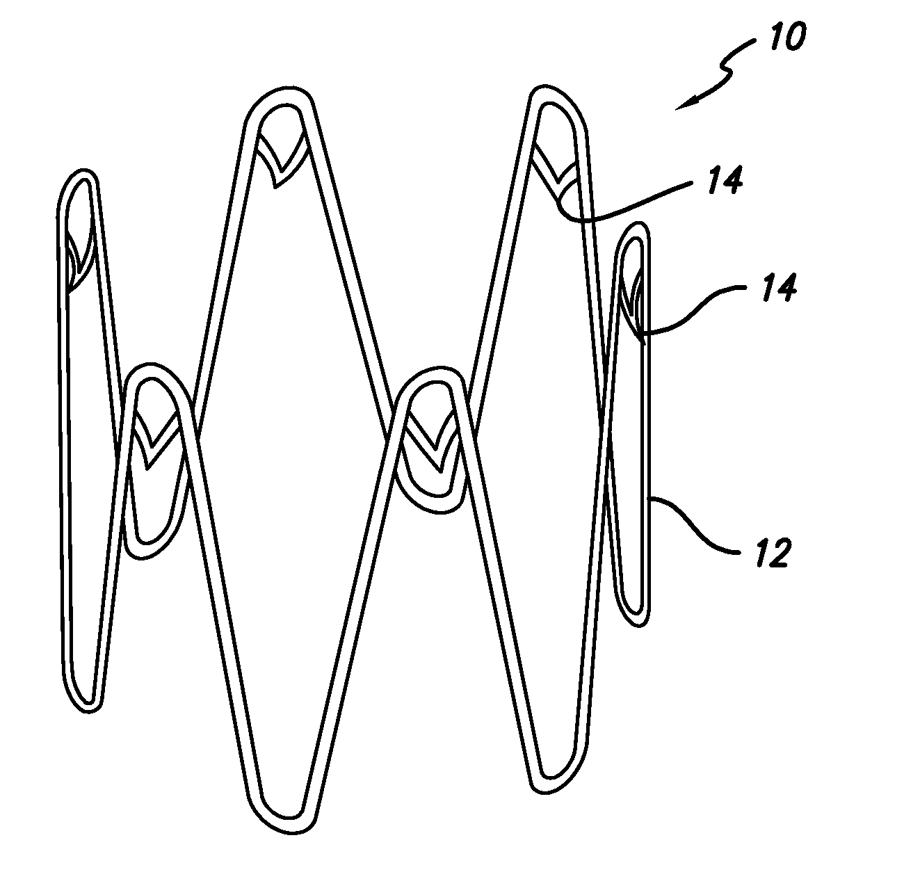 Anchoring device for an endoluminal prosthesis