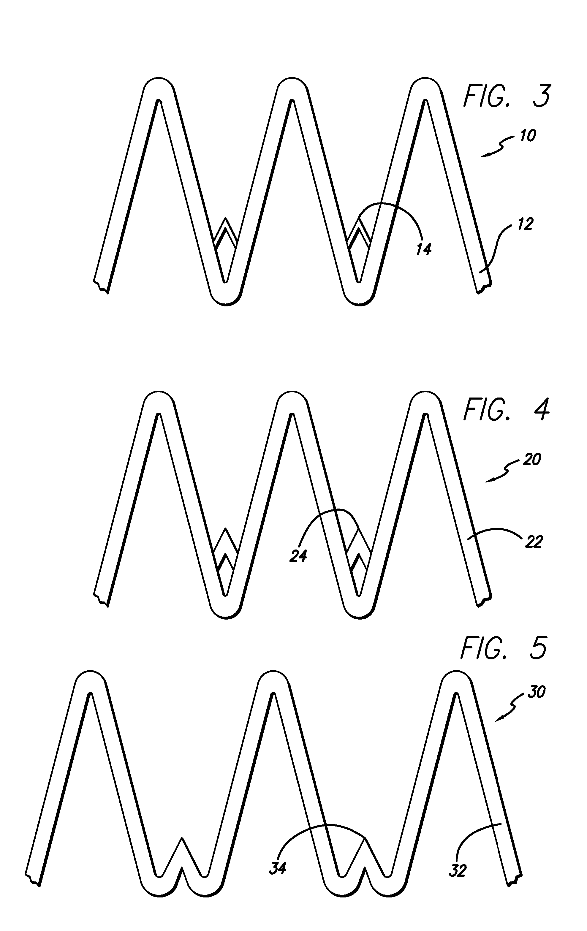 Anchoring device for an endoluminal prosthesis