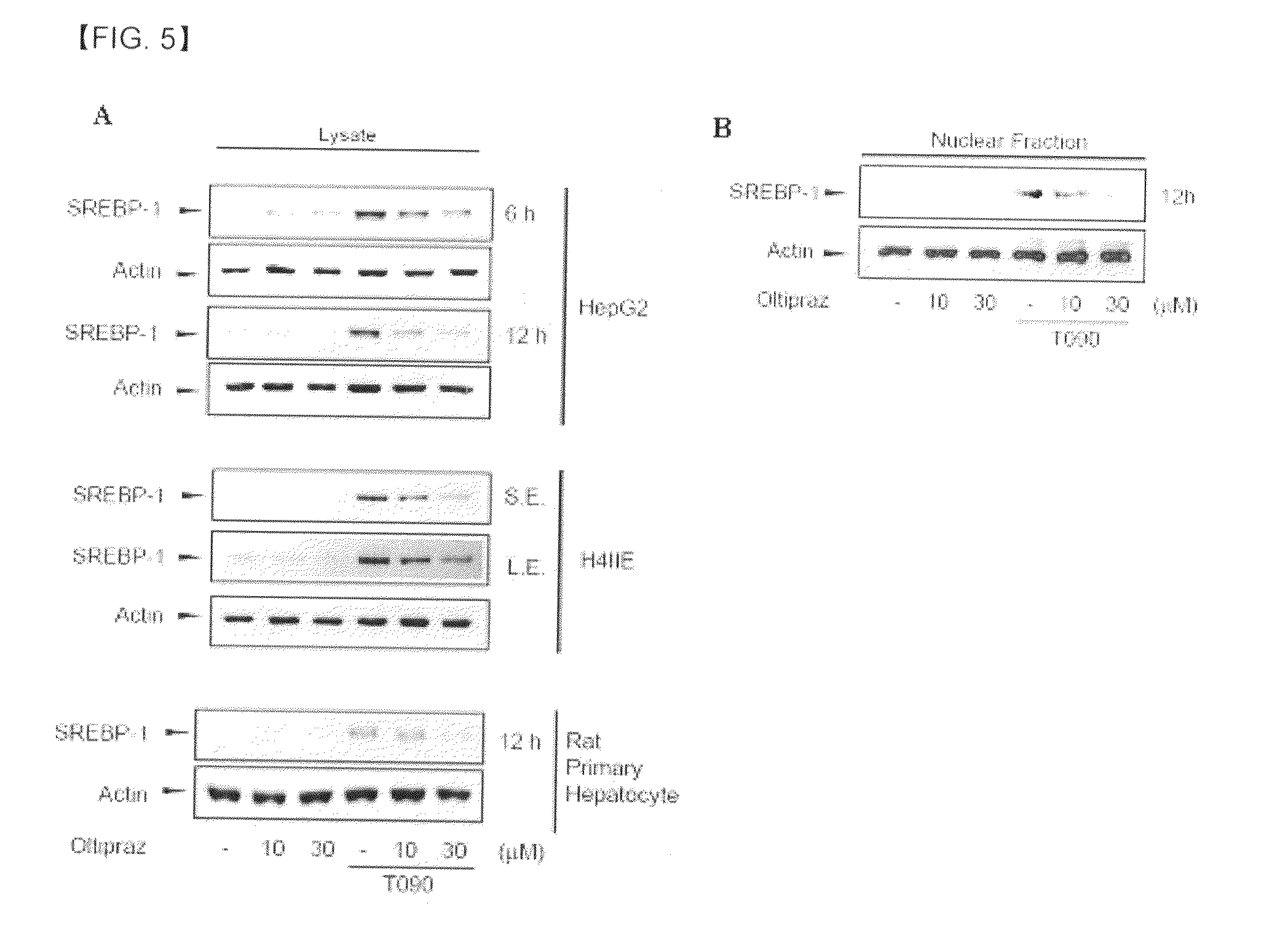 Pharmaceutical composition containing 1,2-dithiolthione derivative for preventing or treating disease caused by overexpression of lxr-alpha