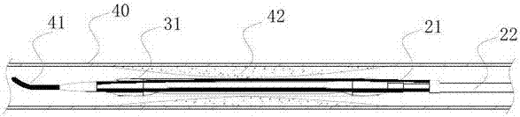 Cutting device for blood vessel plaque