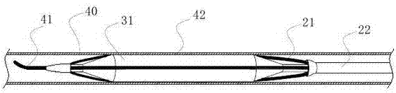 Cutting device for blood vessel plaque