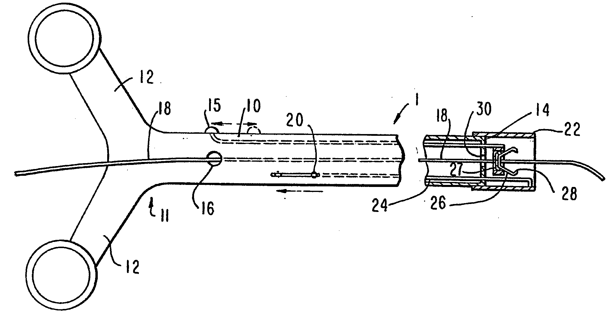 Endovascular Flexible Stapling Device