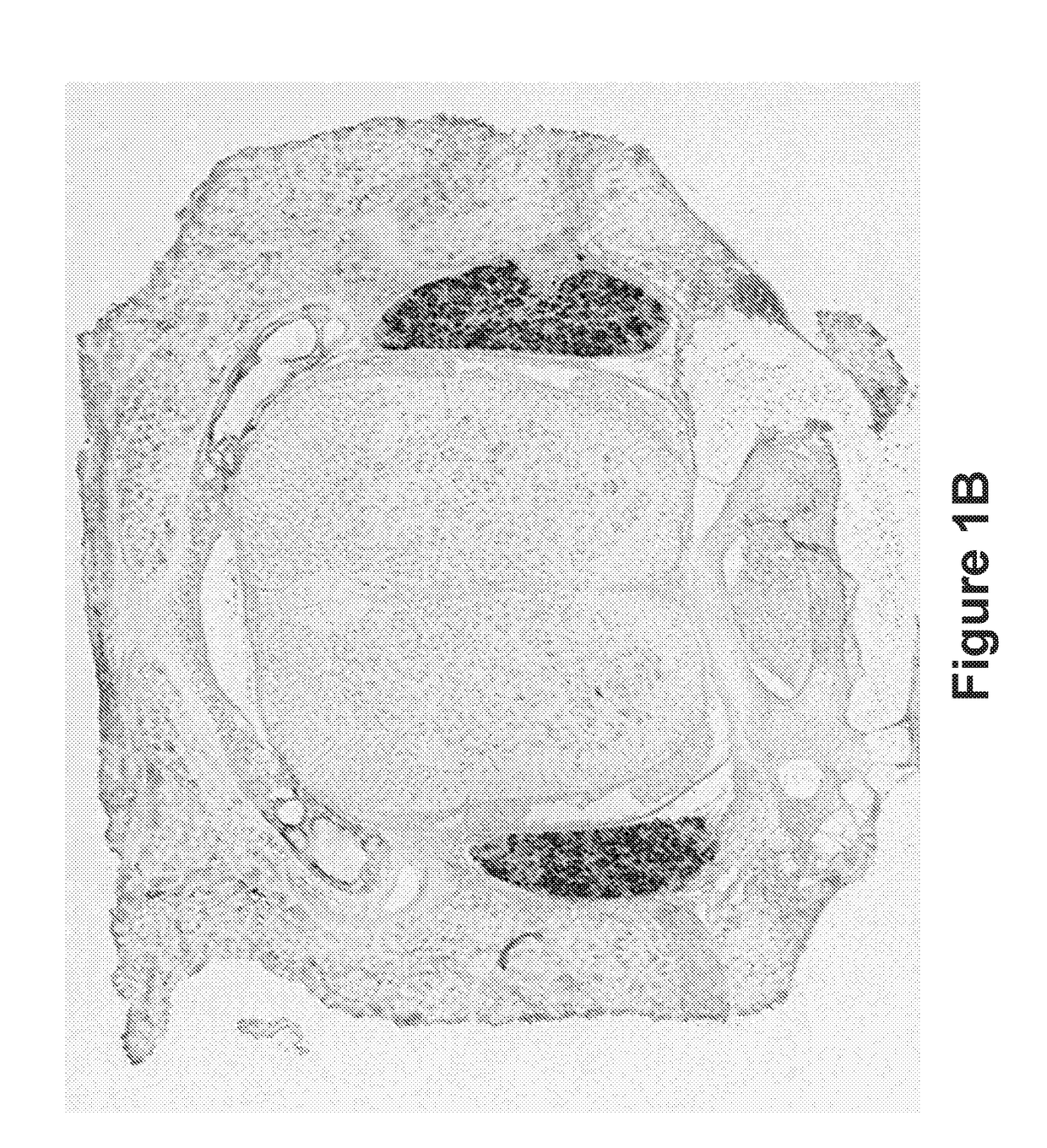 Compositions and methods for treatment of pain