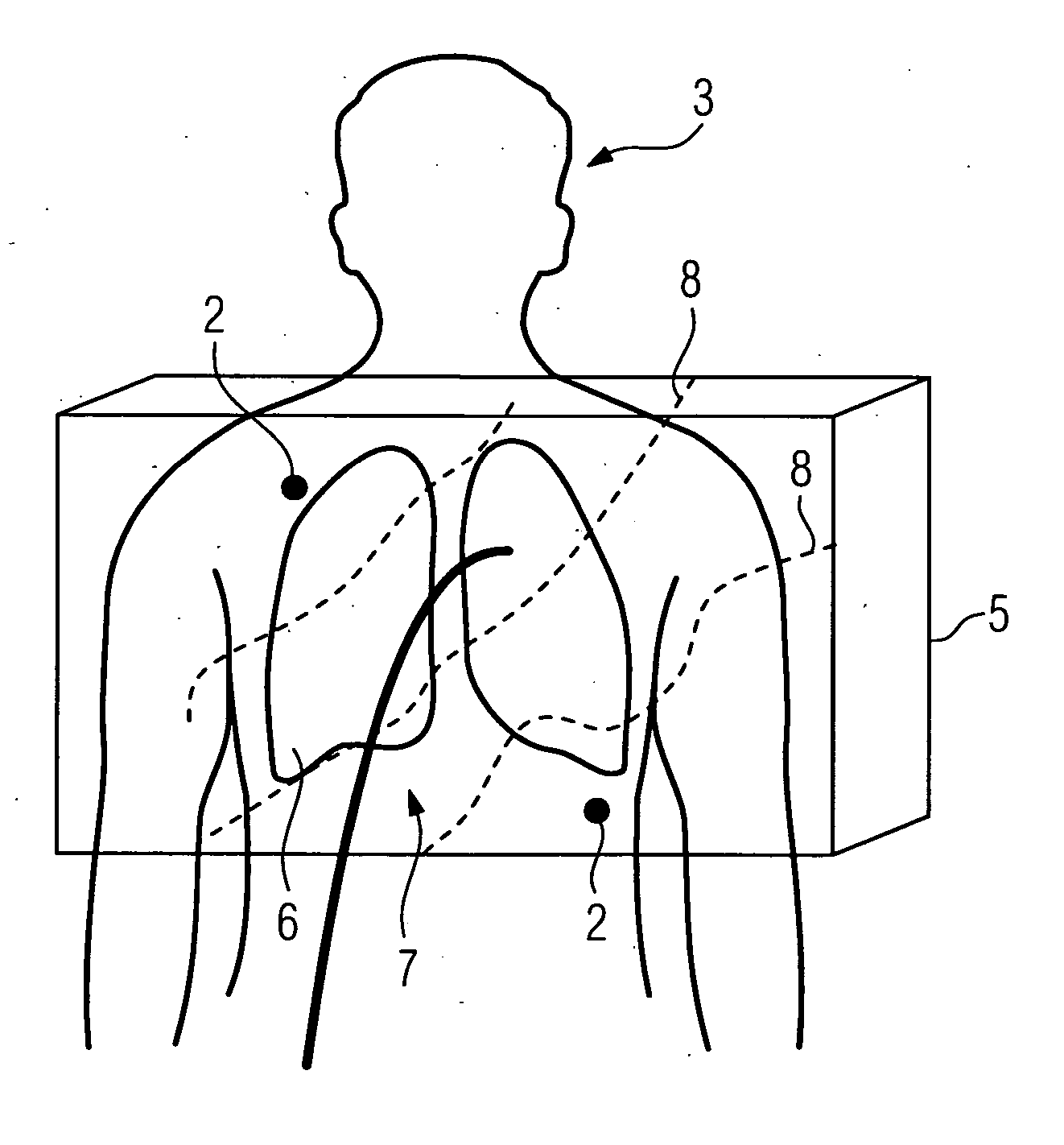 Method for localizing a medical instrument introduced into the body of an examination object