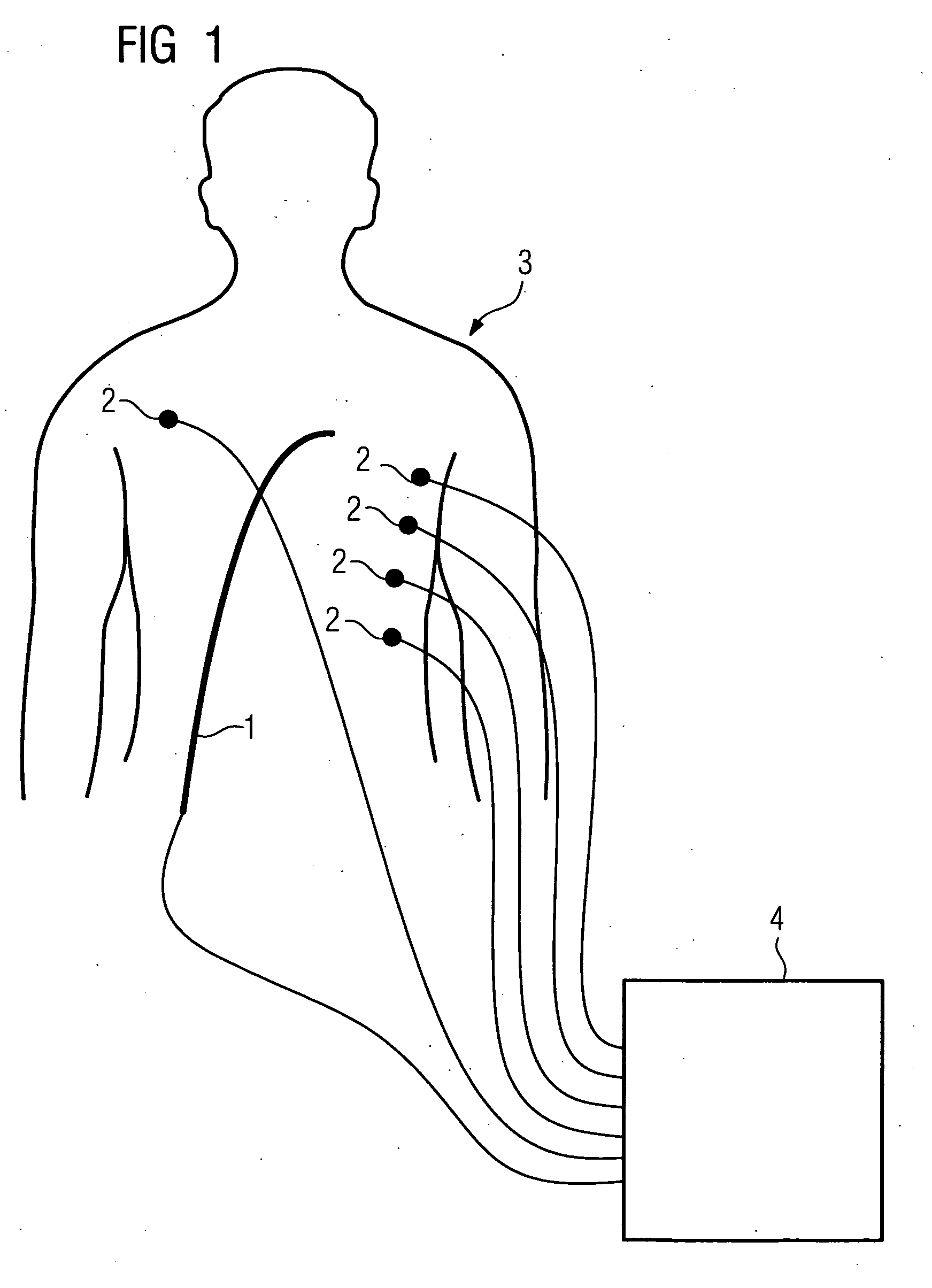 Method for localizing a medical instrument introduced into the body of an examination object