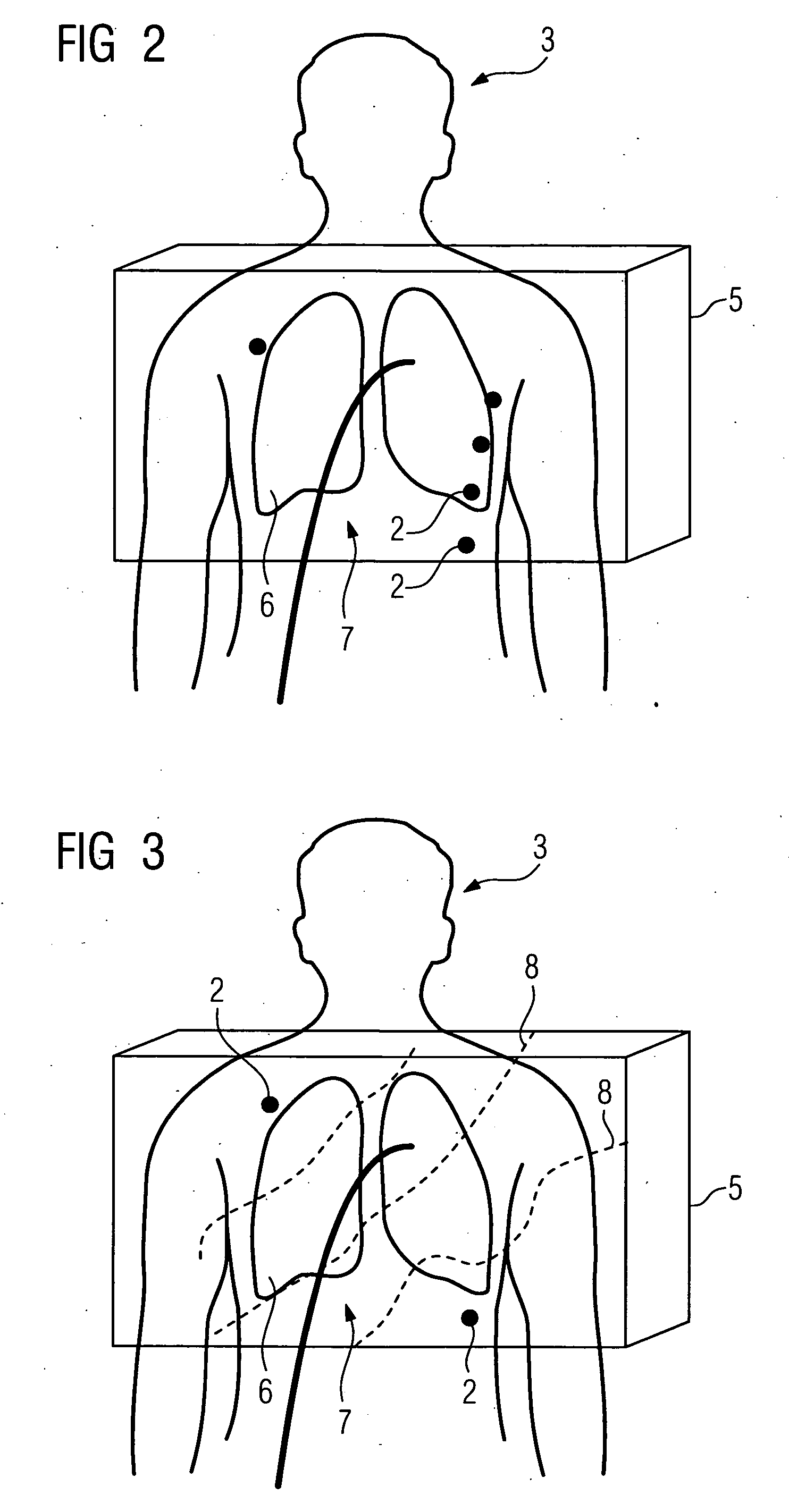 Method for localizing a medical instrument introduced into the body of an examination object