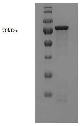 A high-fidelity polymerase with gap DNA preference and its application