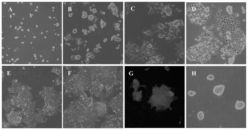 A culture system and method for efficient differentiation of spermatogonial stem cells into neural cells