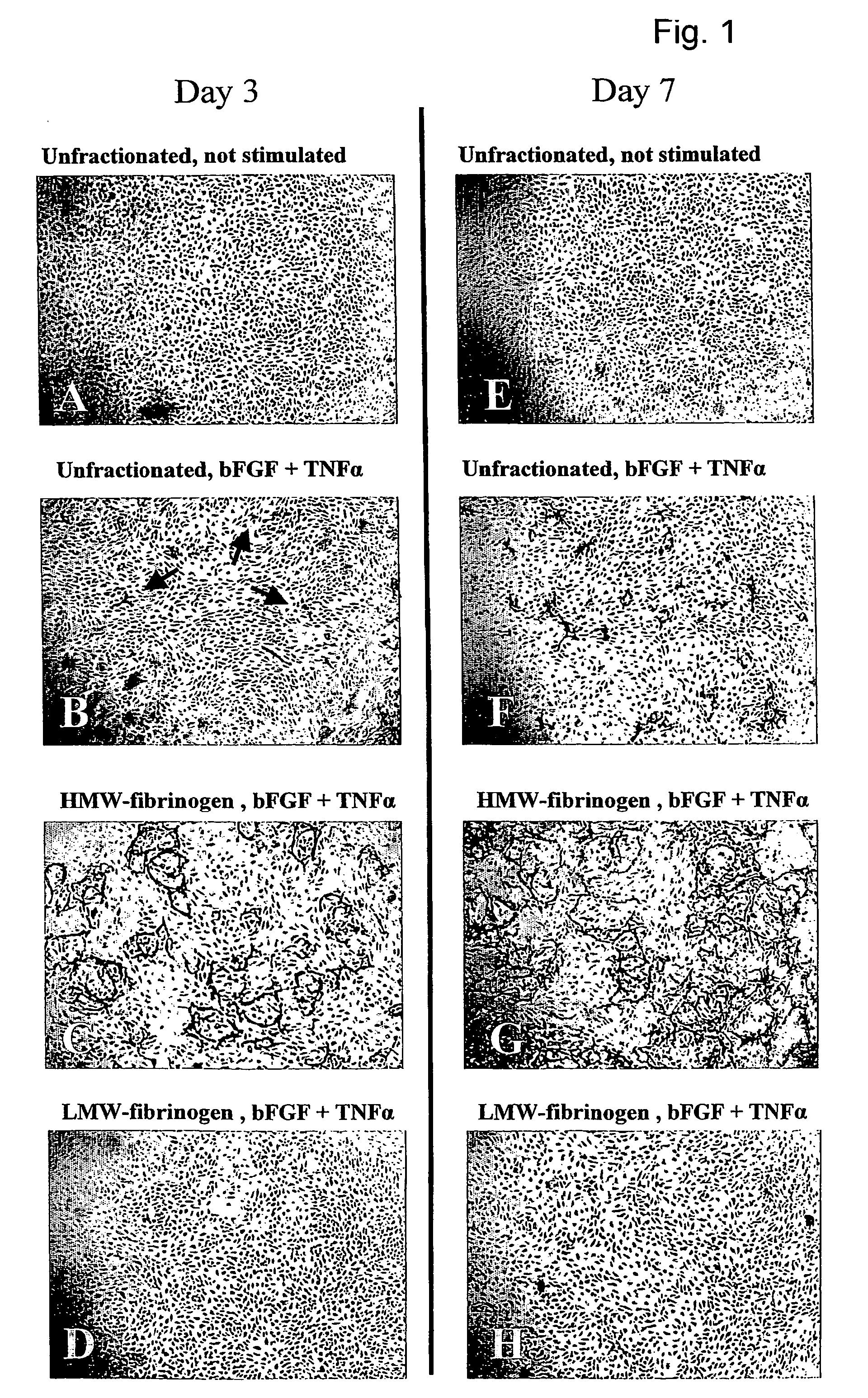 Method for the acceleration or deceleration of angiogenesis using fibrin matrix formed from increased or decreased HMW/LMW fibrinogen ratio