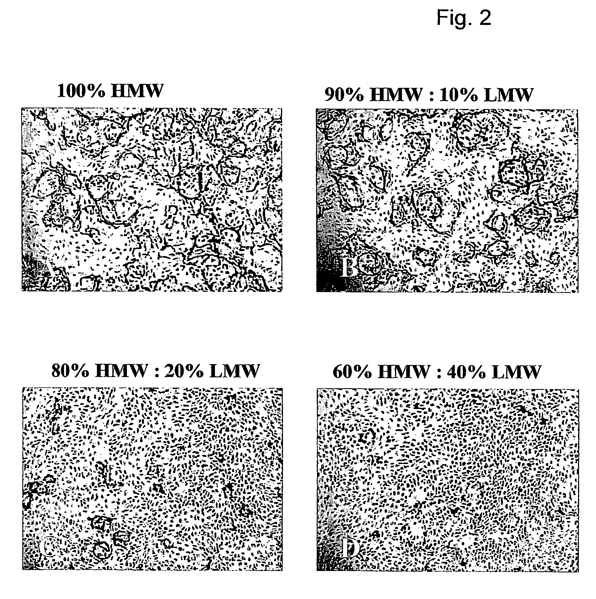 Method for the acceleration or deceleration of angiogenesis using fibrin matrix formed from increased or decreased HMW/LMW fibrinogen ratio