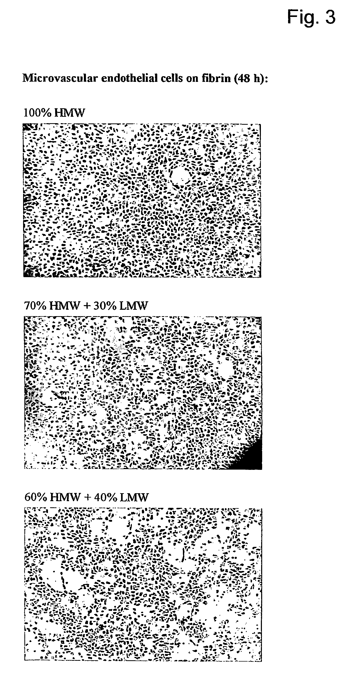 Method for the acceleration or deceleration of angiogenesis using fibrin matrix formed from increased or decreased HMW/LMW fibrinogen ratio