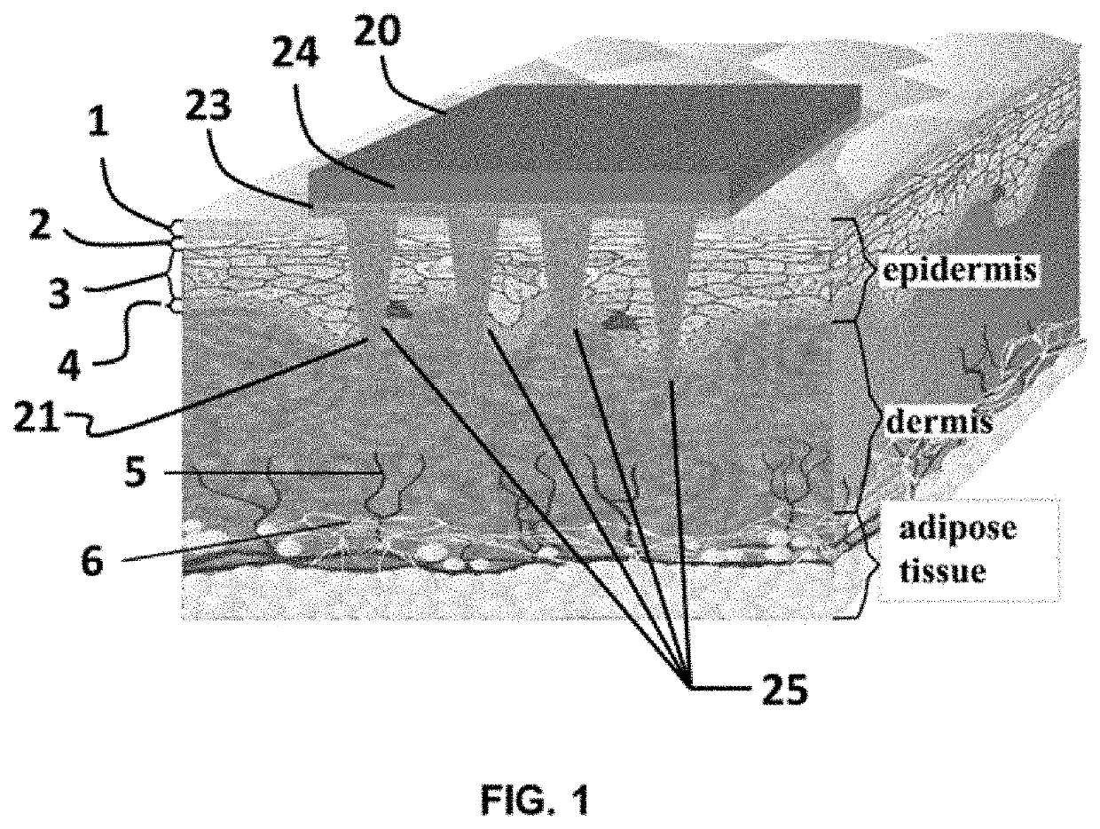 Microneedle patch for transdermal injections