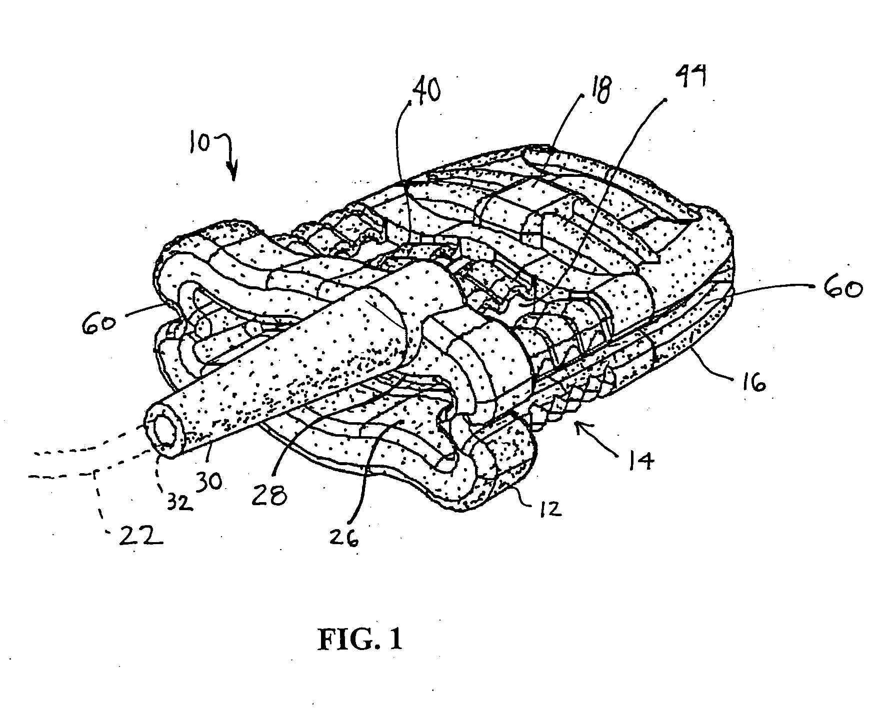 Sensor assembly