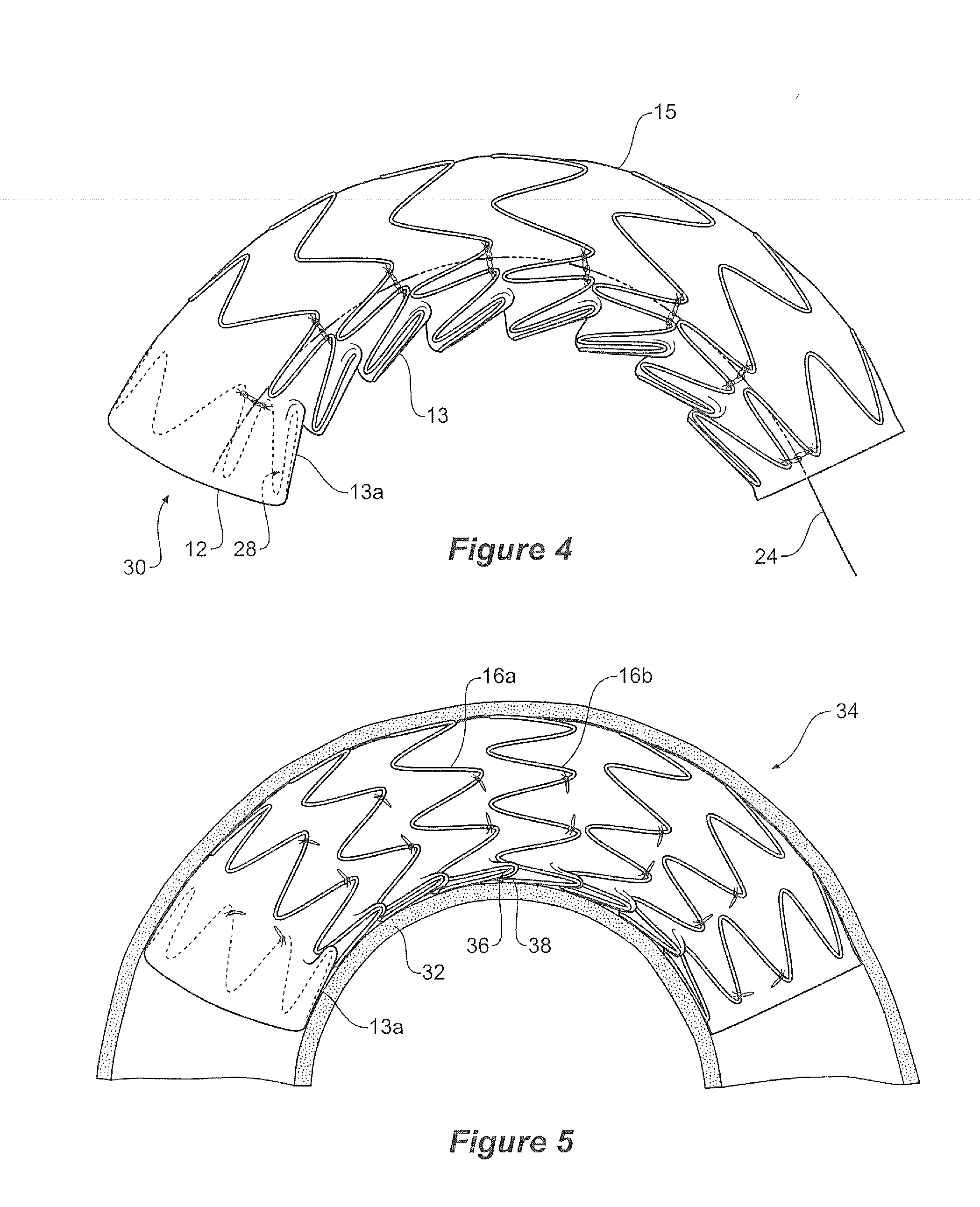 Curve forming stent graft