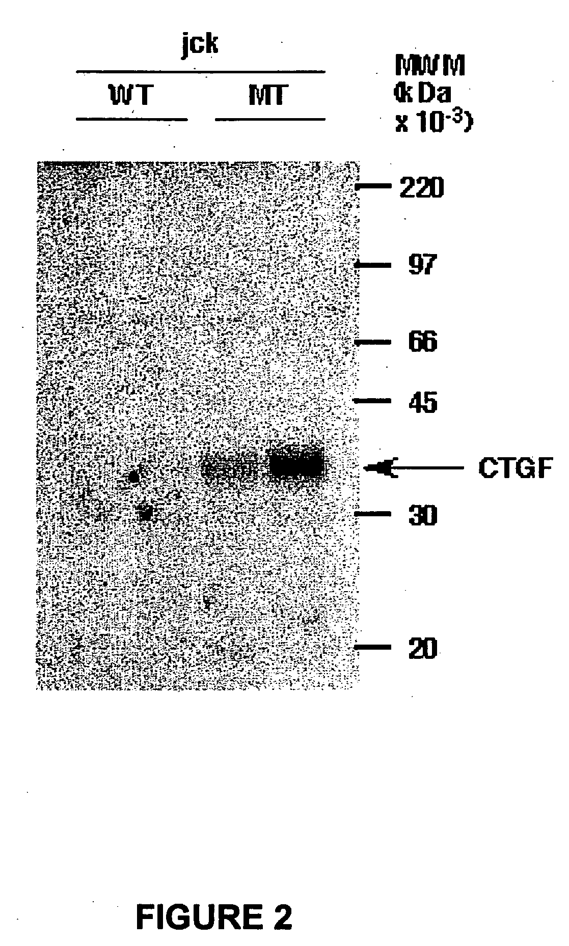 Methods and compositions for the treatment of polycystic diseases