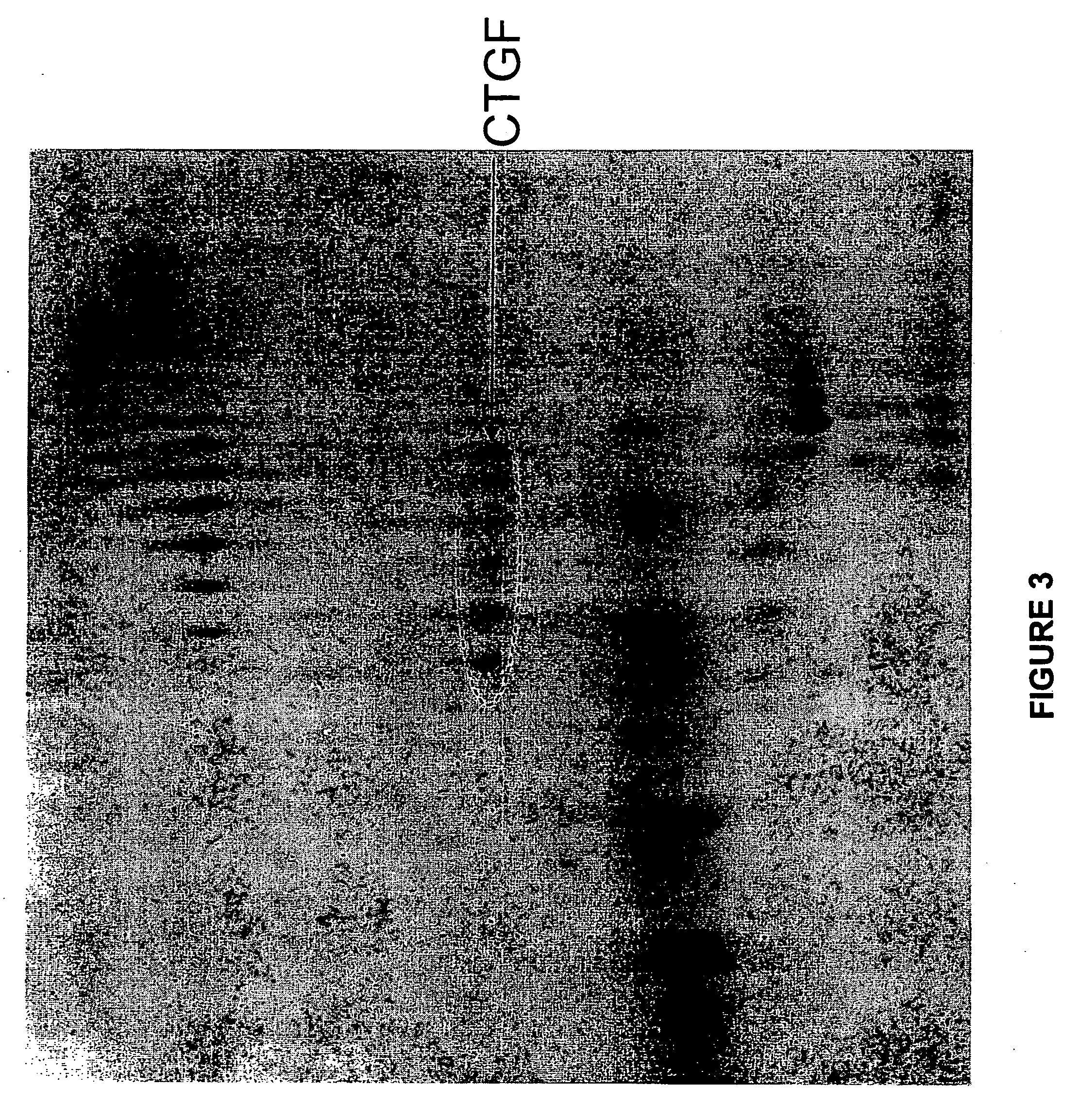 Methods and compositions for the treatment of polycystic diseases