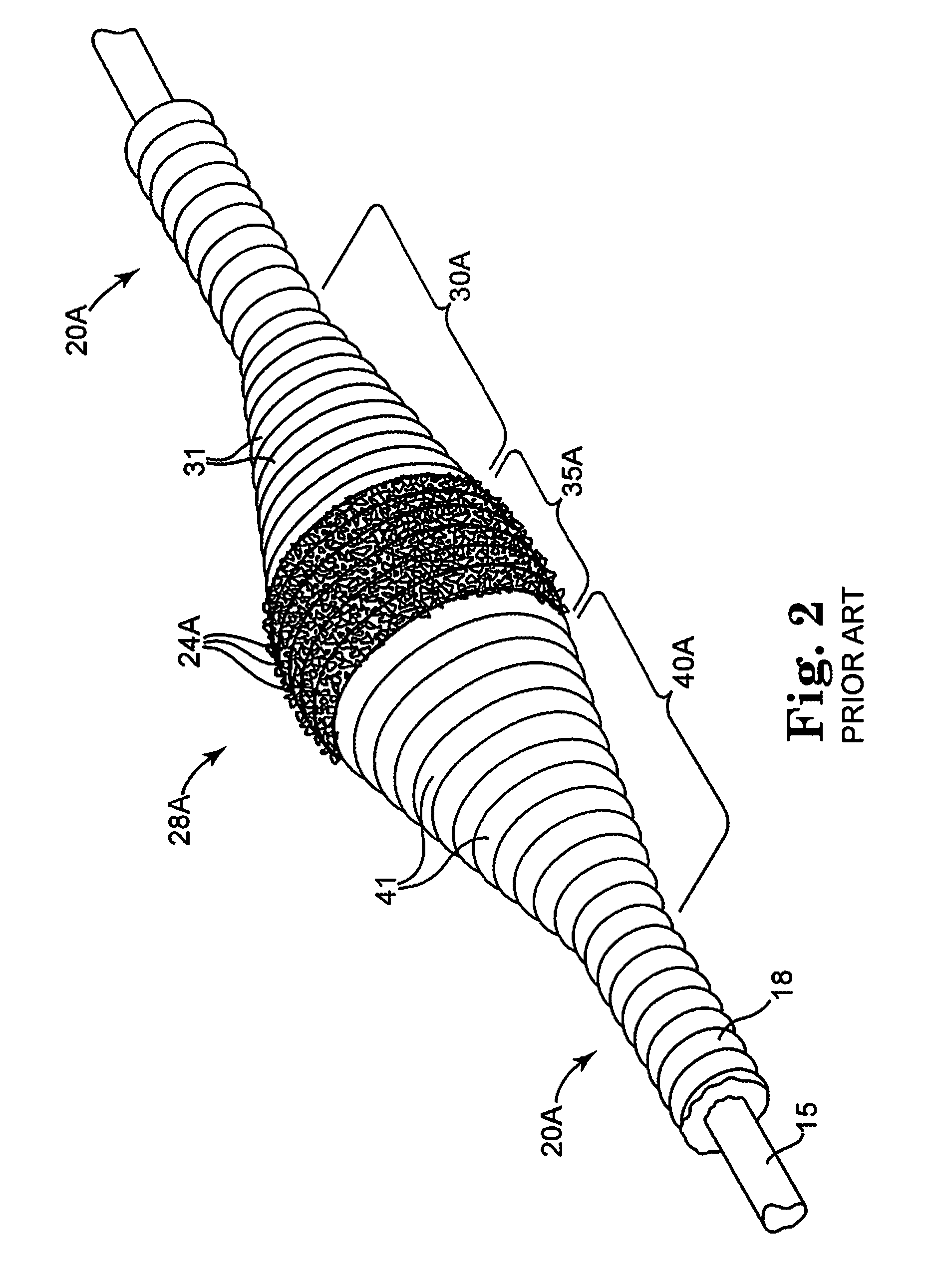 Rotational atherectomy device and method to improve abrading efficiency