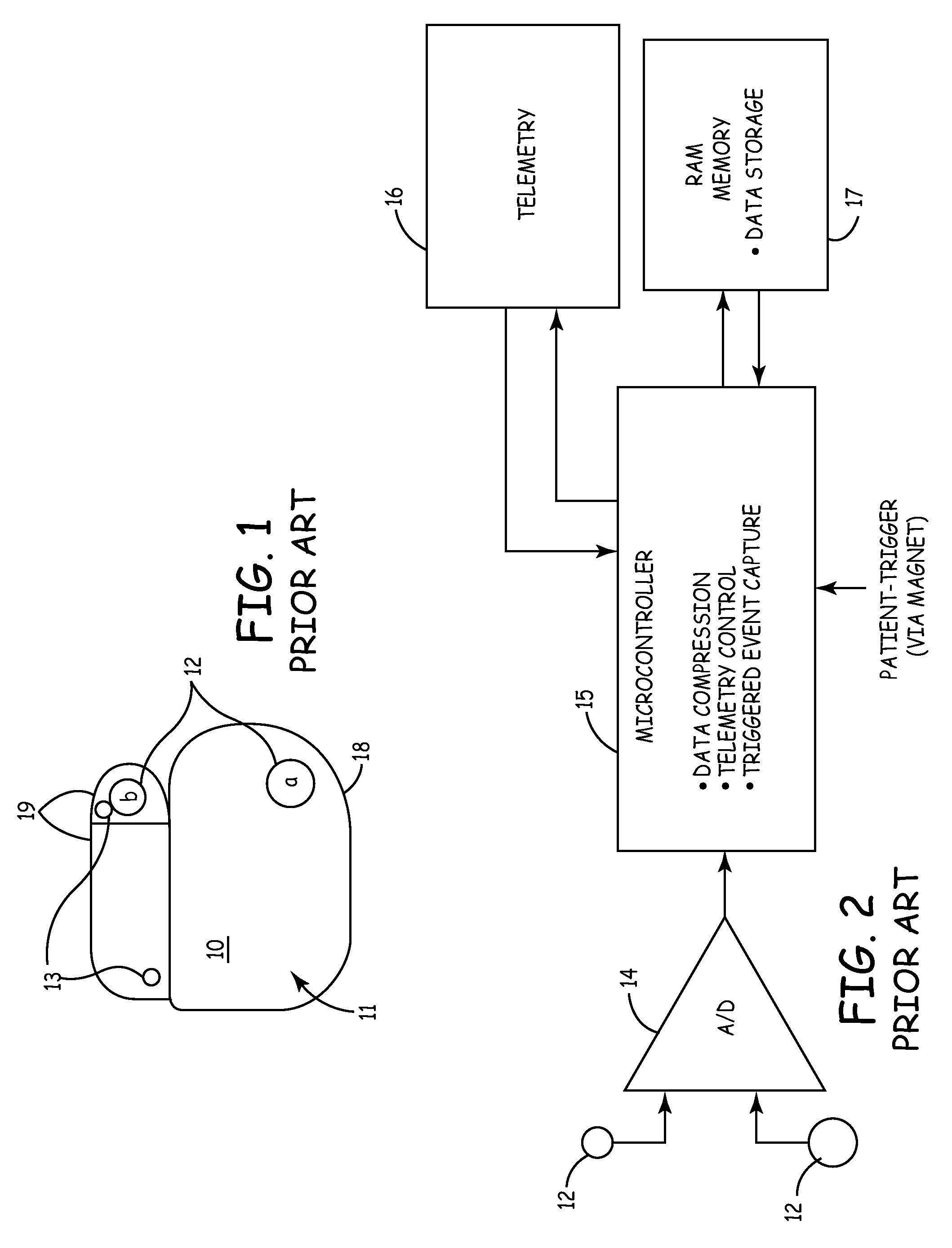 Implantable medical device with patient input mechanism