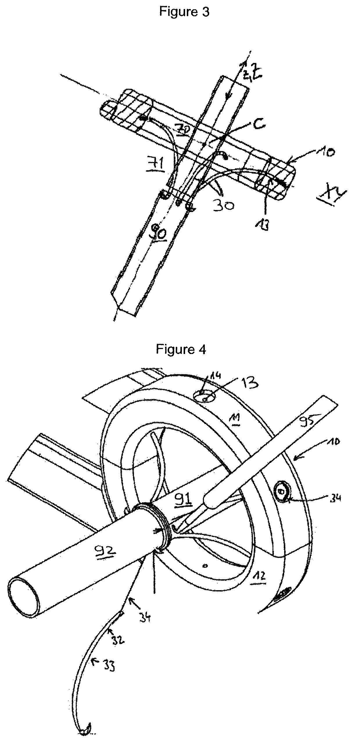 Device for communicably coupling a first and a second organ body