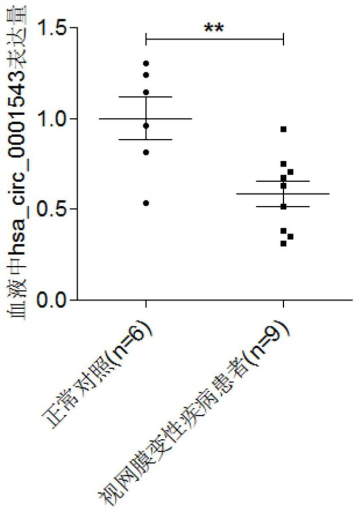 Application of hsa-mir-382-5p in preparation of kits for diagnosing retinal degenerative diseases