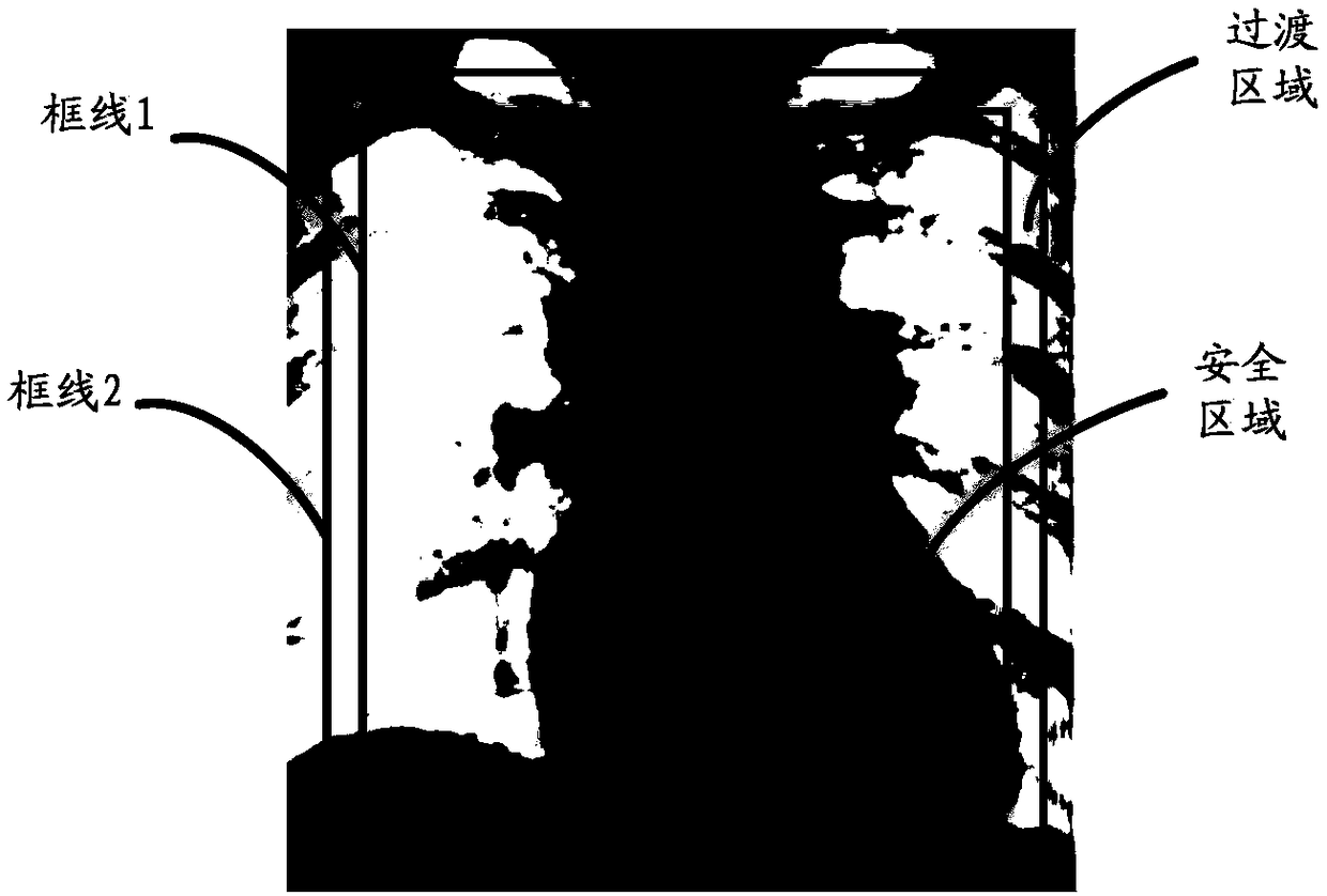 Angiography method, device, system and equipment and storage medium