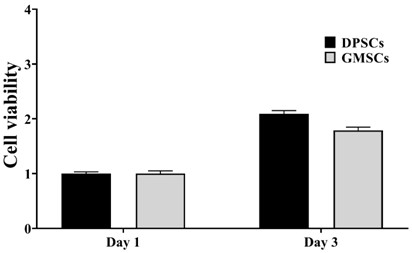 Application of OPTN gene in identification of dental pulp stem cells for identifying dental pulp stem cells and method thereof and product