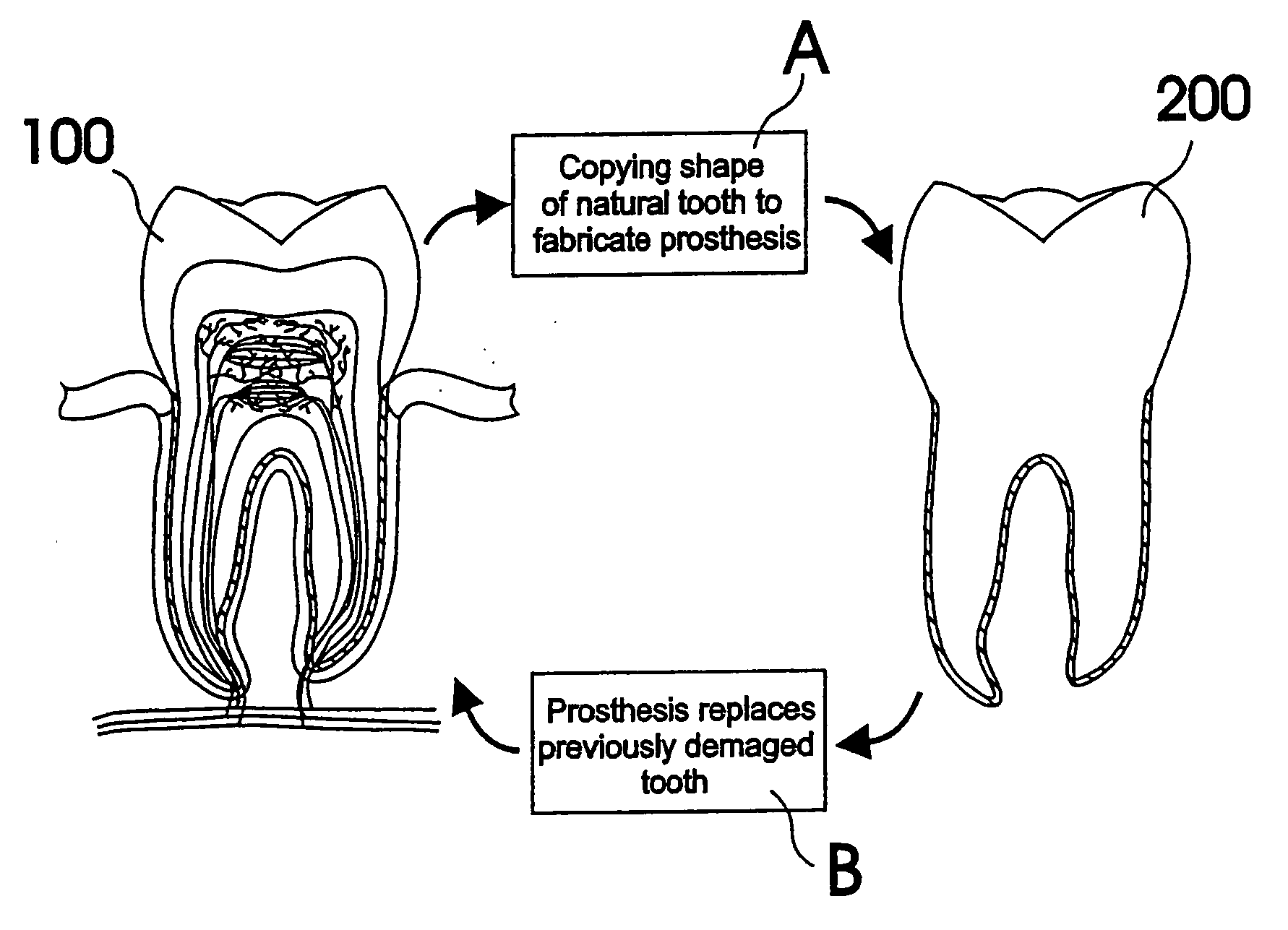 Customized dental prosthesis for periodontal- or osseointegration, and related systems and methods