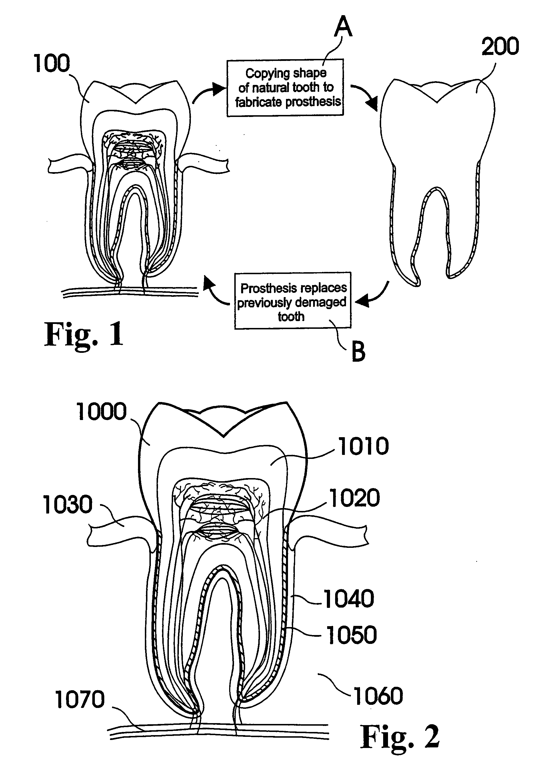 Customized dental prosthesis for periodontal- or osseointegration, and related systems and methods