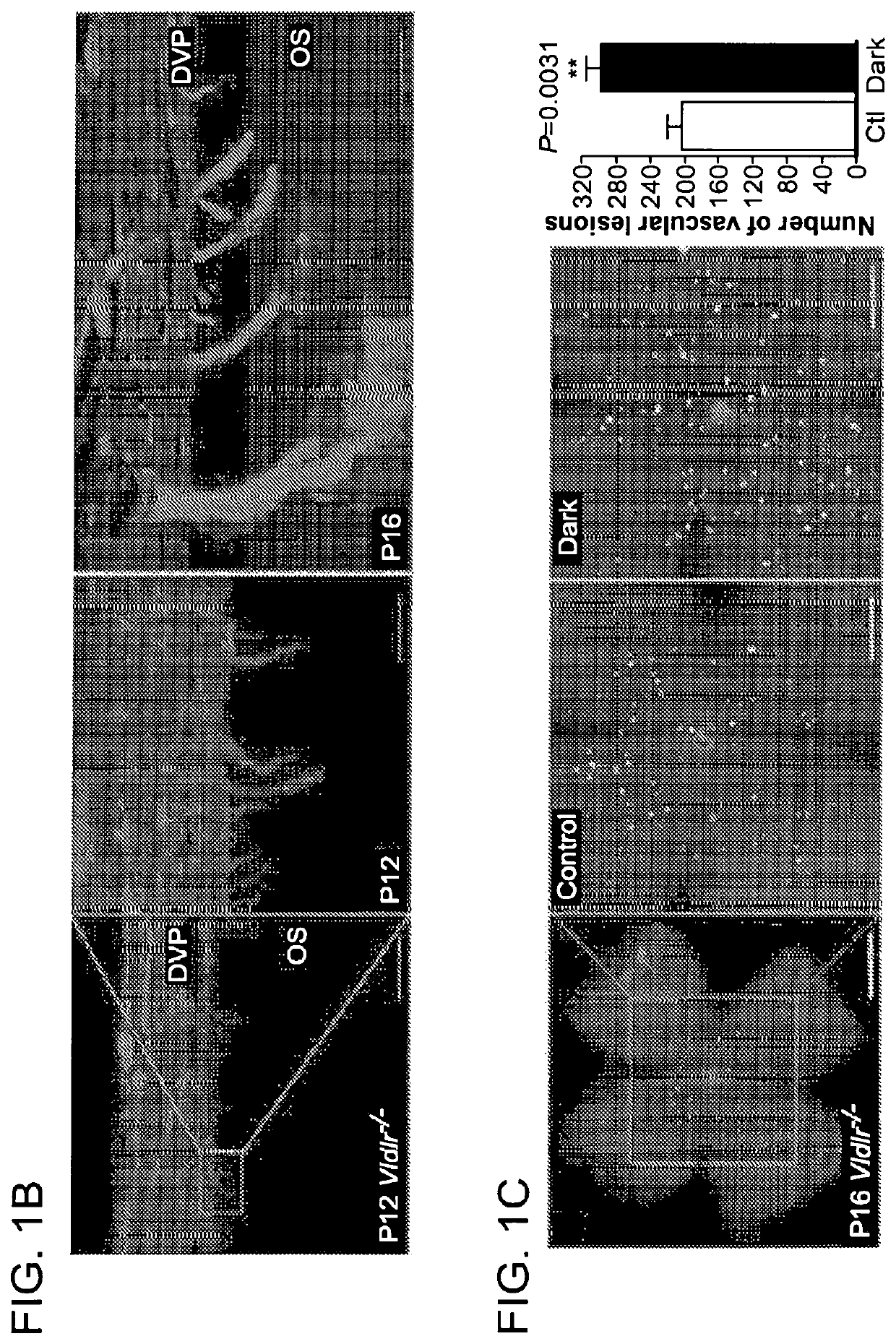 Ffa1 (GPR40) as a therapeutic target for neural angiogenesis diseases or disorders