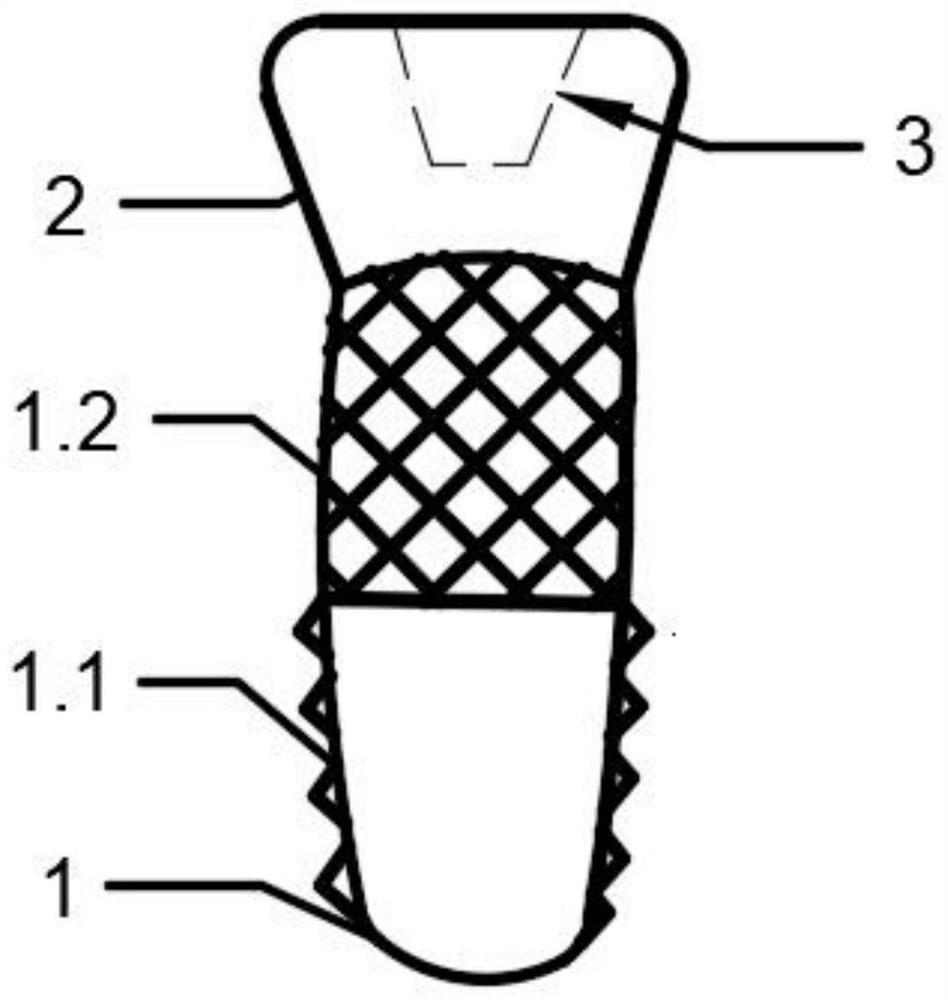 Integrated dental implant