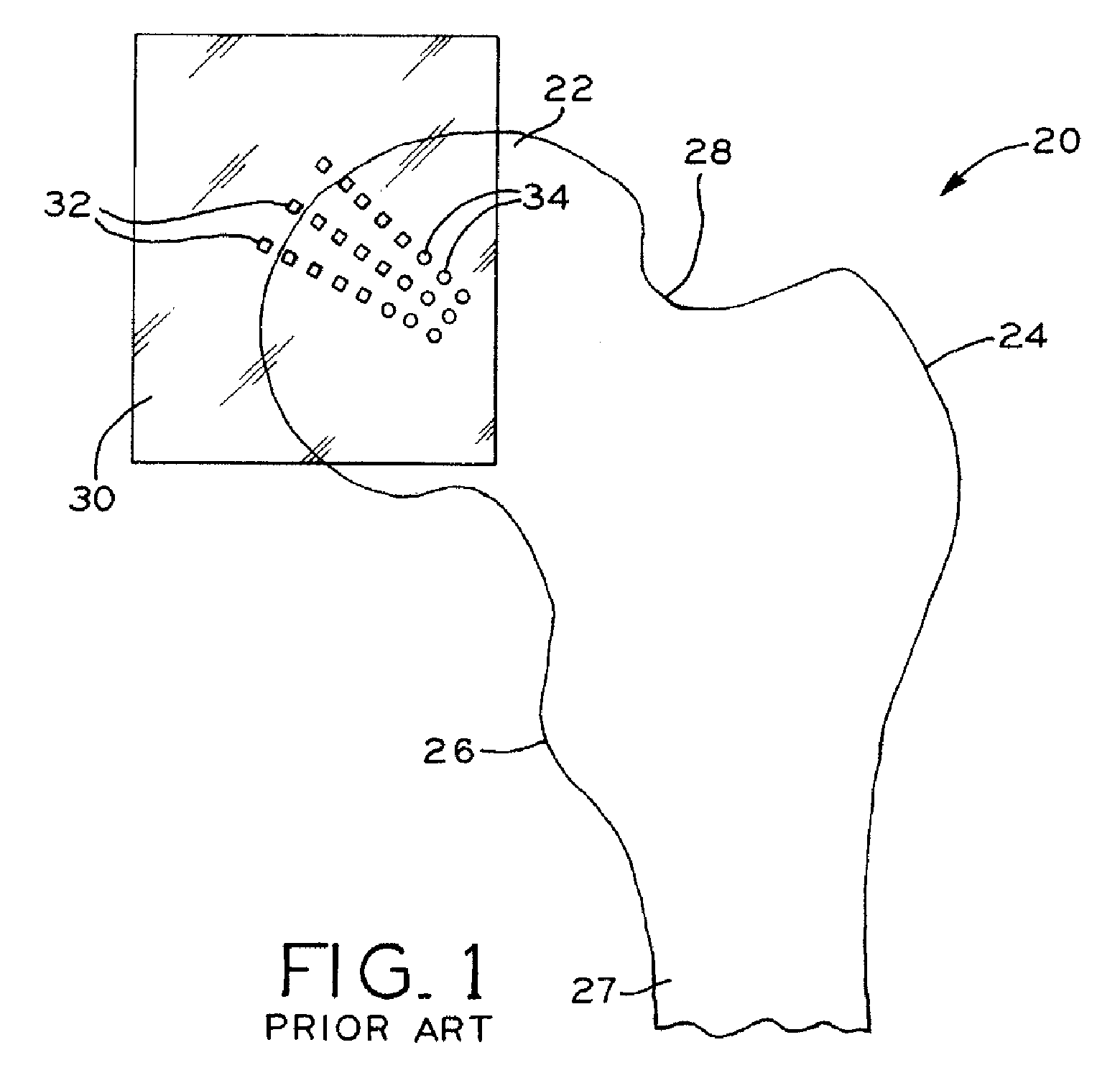 Modular orthopaedic component case