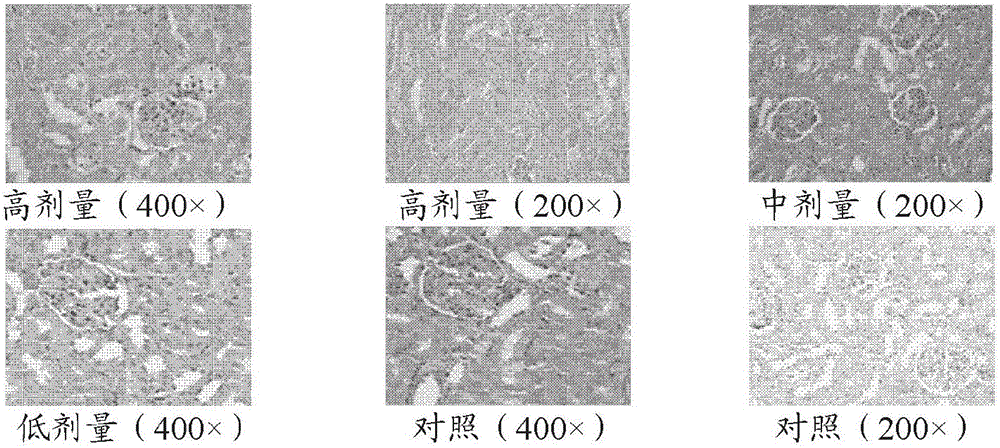 A kind of rhubarb anthraquinone oral colon targeted drug delivery composition and use thereof