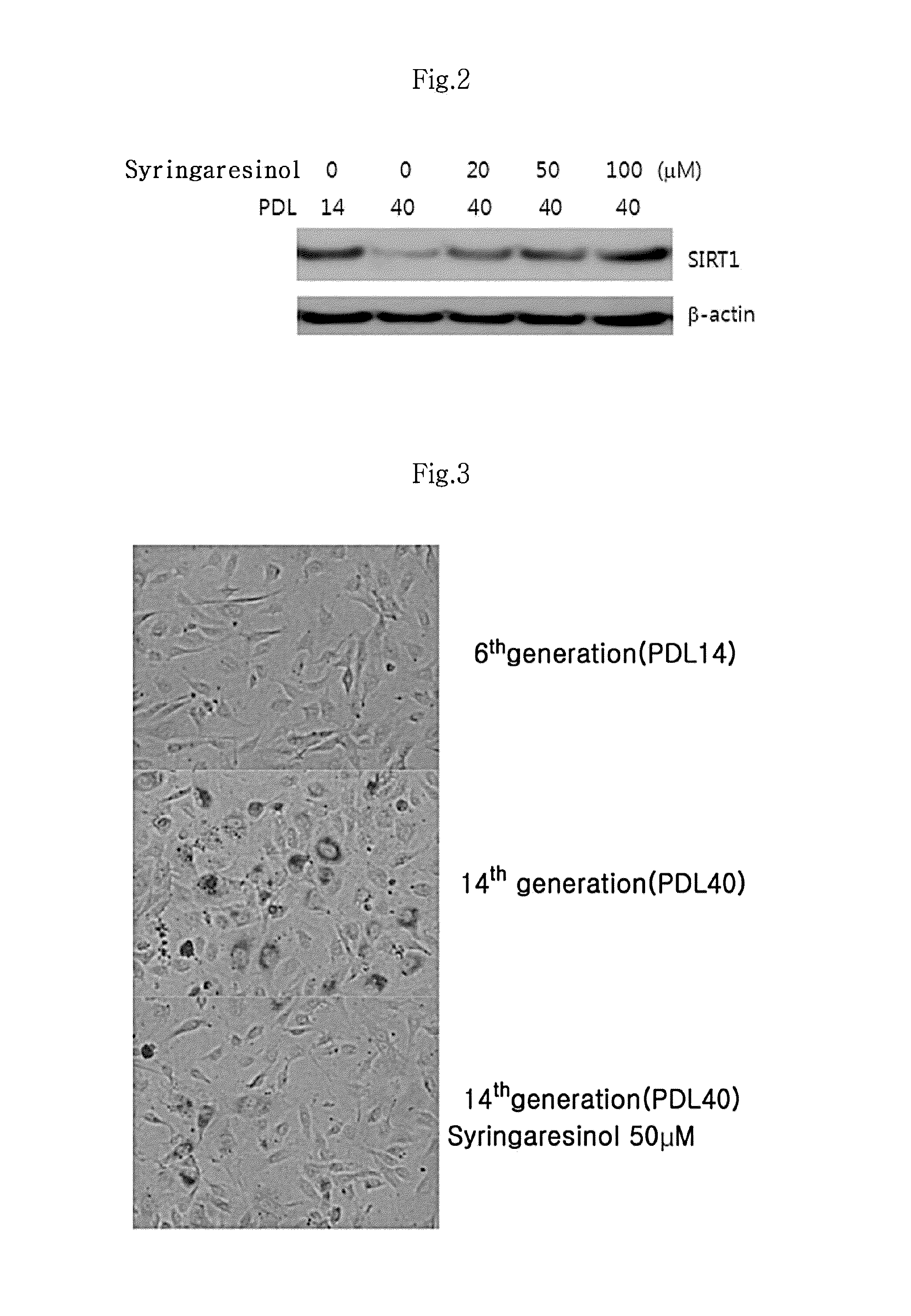 Composition for inhibiting vascular aging comprising syringaresinol