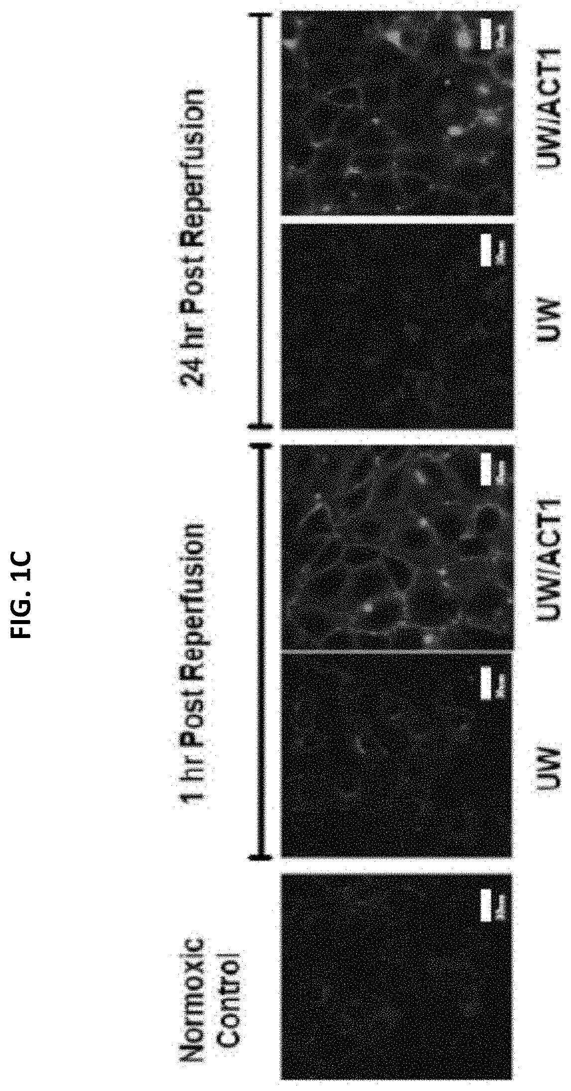 Compositions and methods for preserving organ transplants