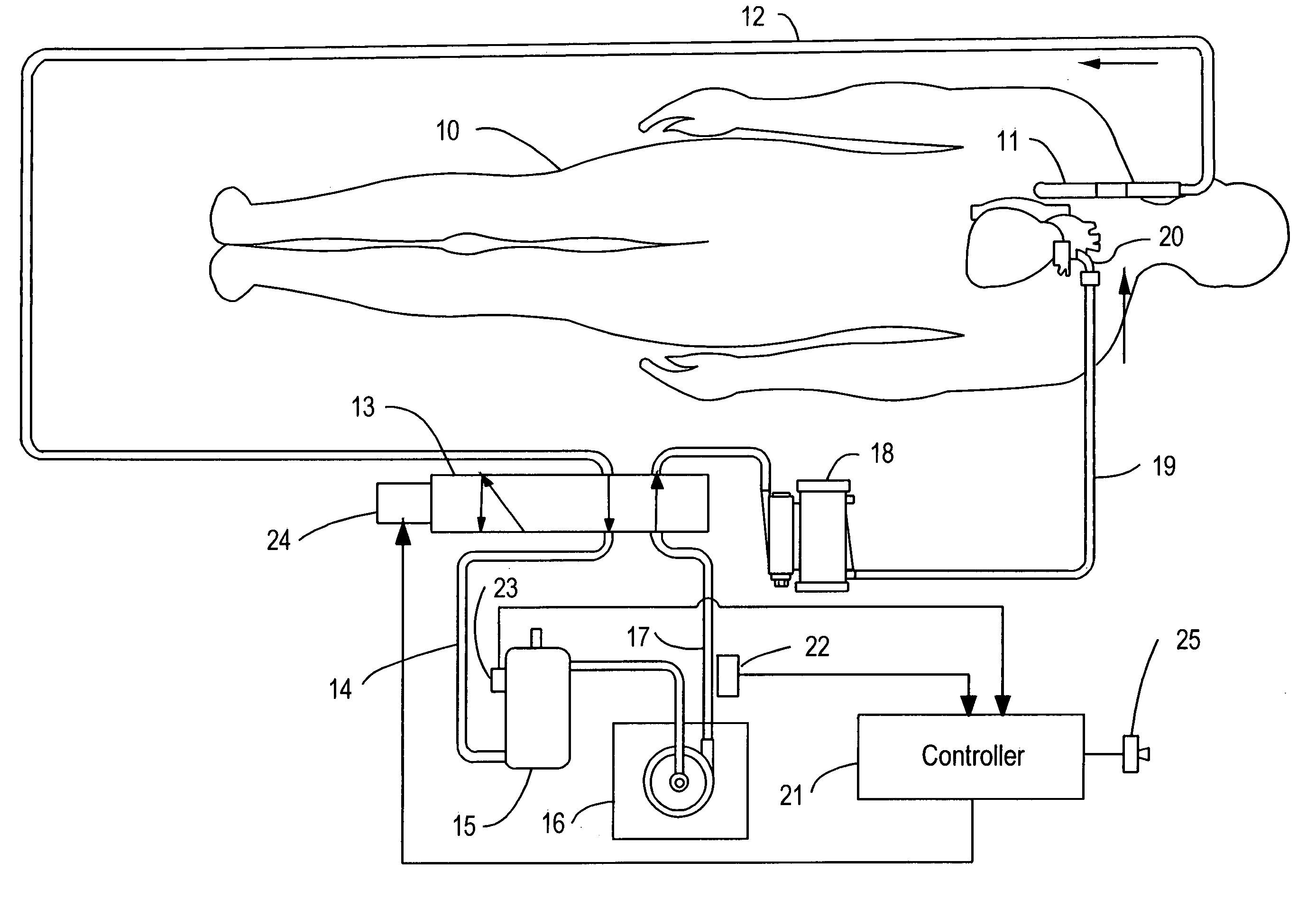 System and method of air embolism detection and diversion