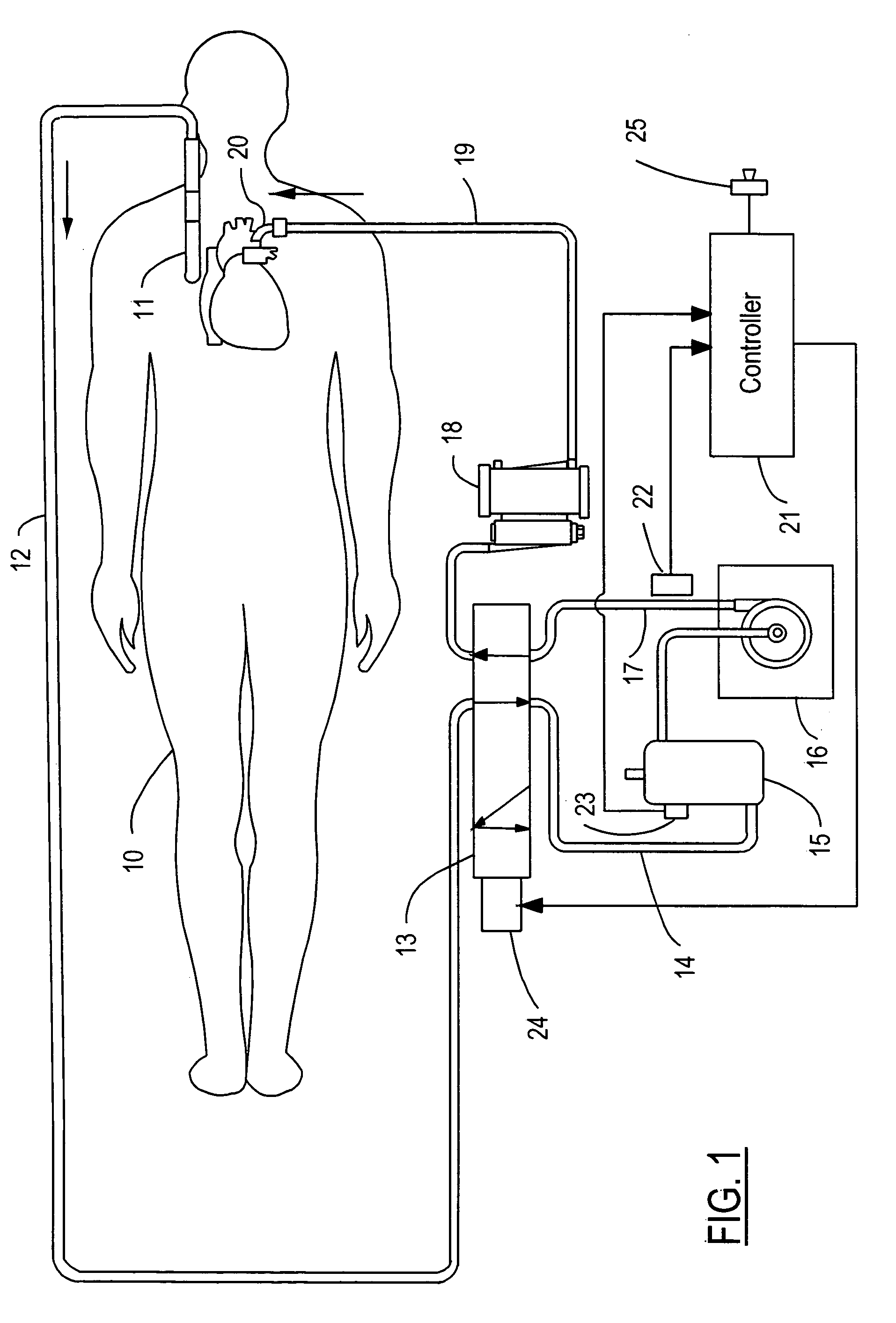 System and method of air embolism detection and diversion