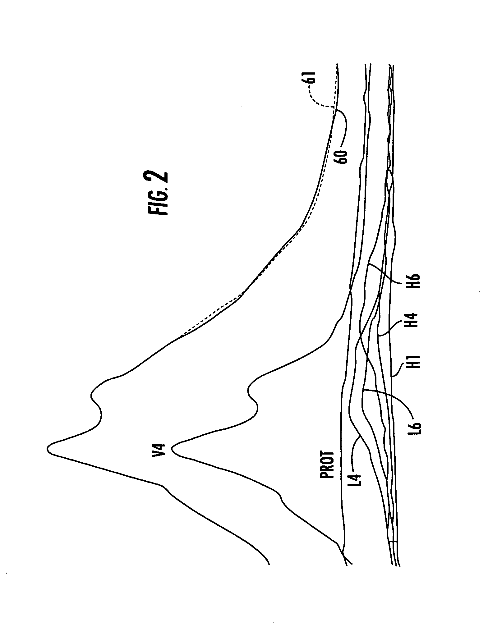 NMR clinical analyzers and related methods, systems, modules and computer program products for clinical evaluation of biosamples