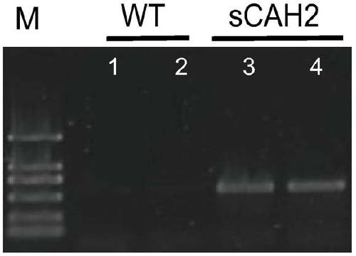 A gene encoding chloroplast carbonic anhydrase was used in the construction of high-concentration co  <sub>2</sub> and applications in fast-growing industrial engineered microalgae