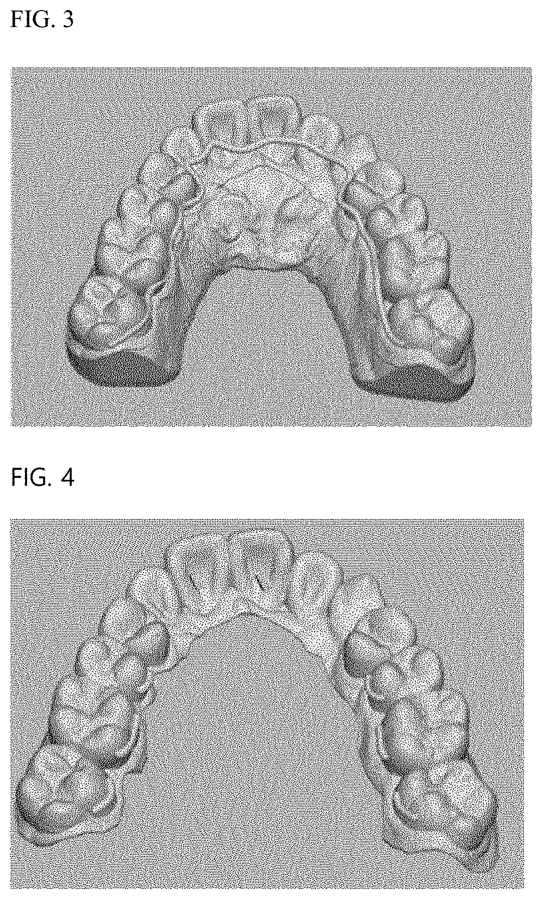 Photocurable composition for 3D printer for producing transparent orthodontic device