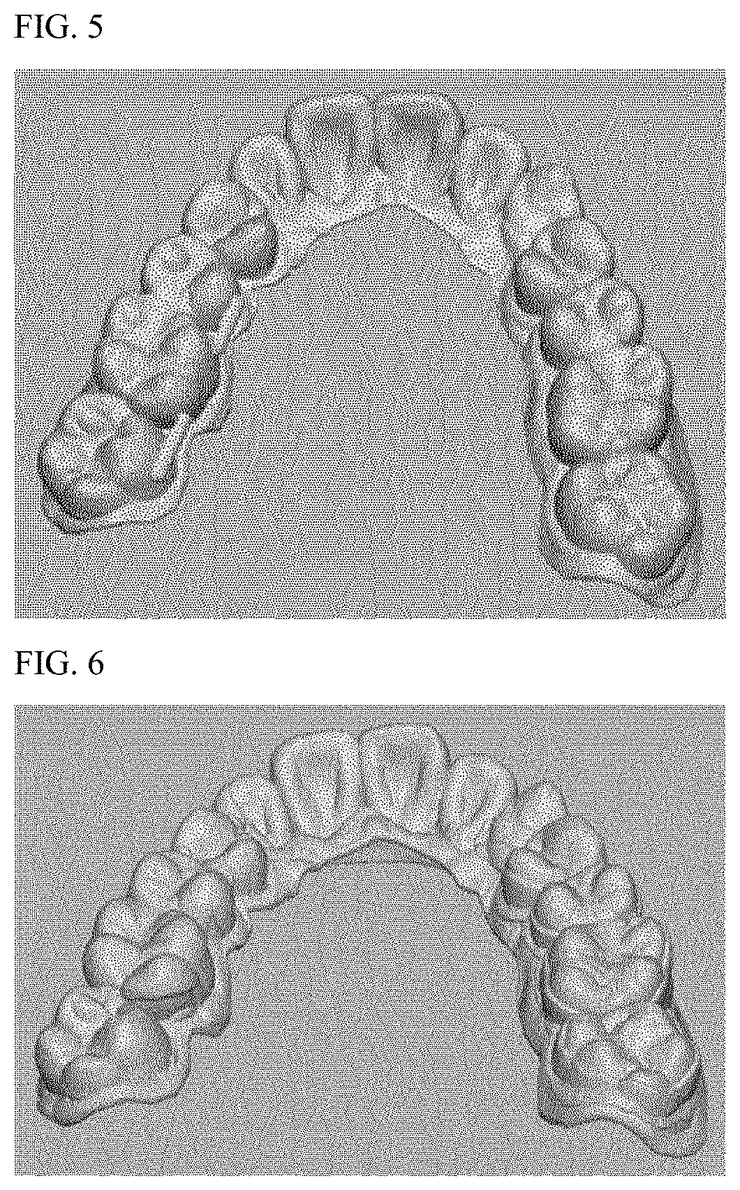 Photocurable composition for 3D printer for producing transparent orthodontic device