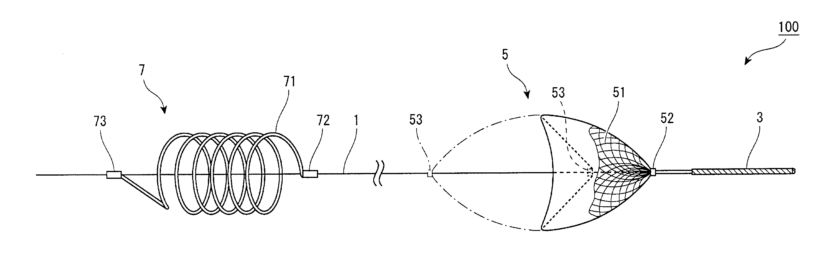 Embolic material excision trapping device