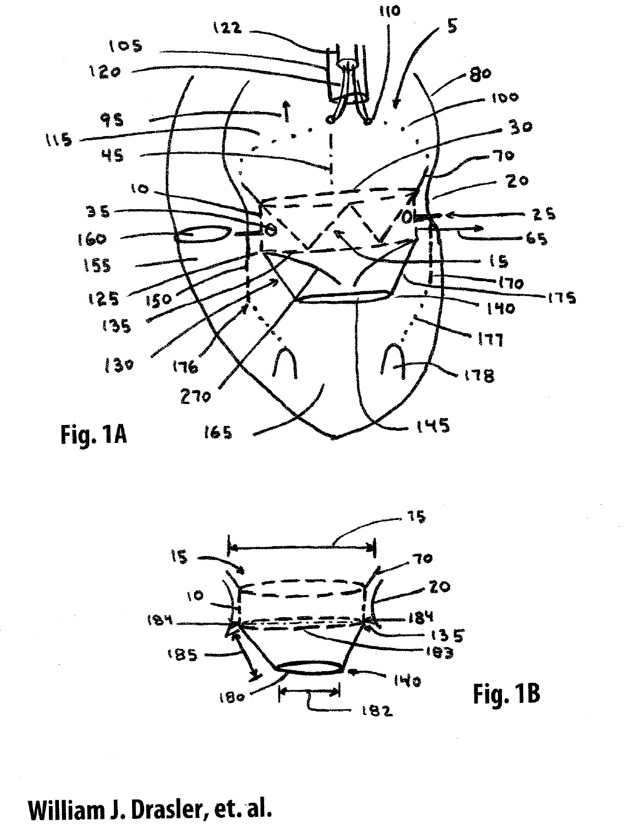 Straddle Annular Mitral Valve